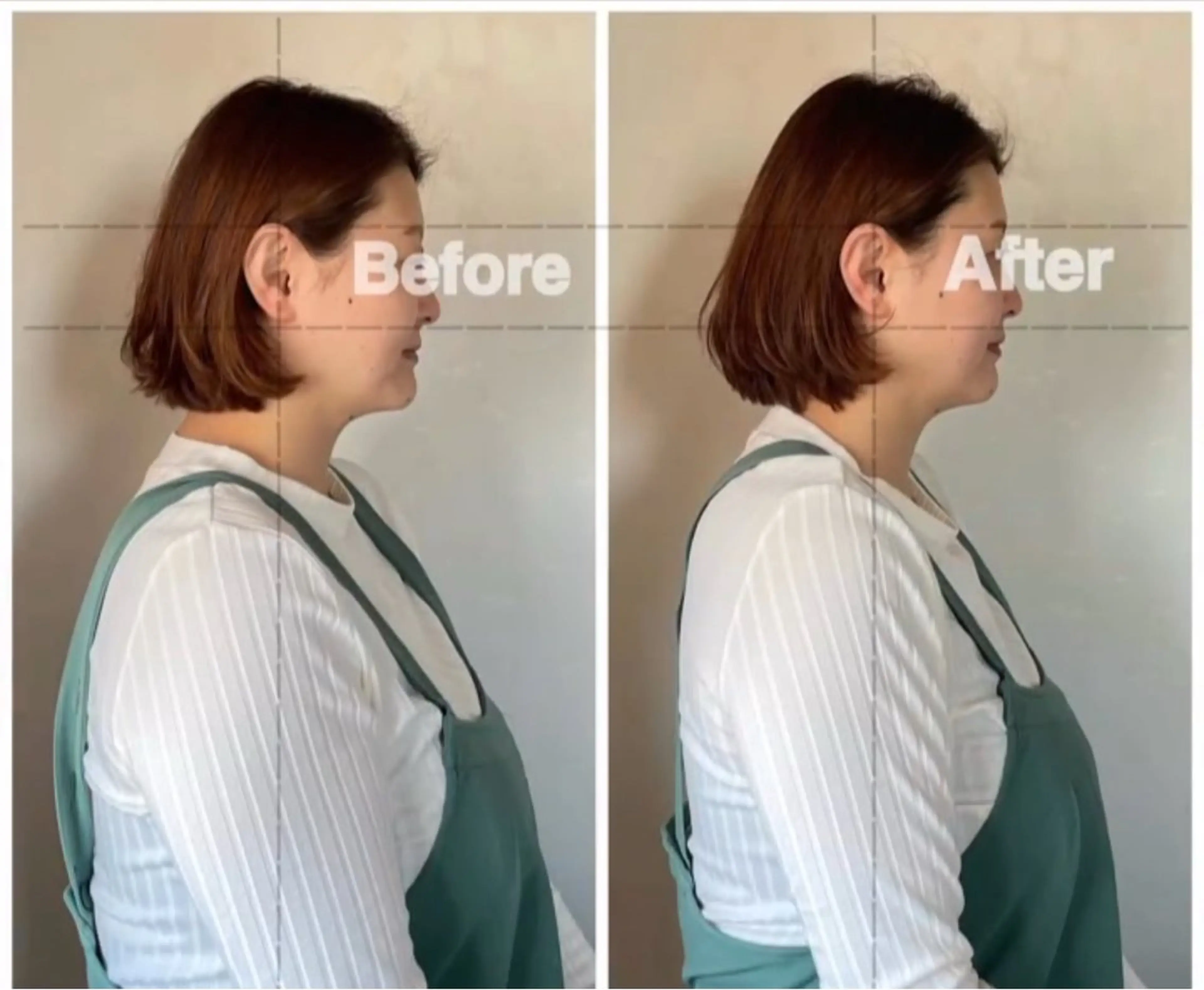 疲労回復整体、肩こり、腰痛、坐骨神経痛、頭痛、姿勢バランスの写真