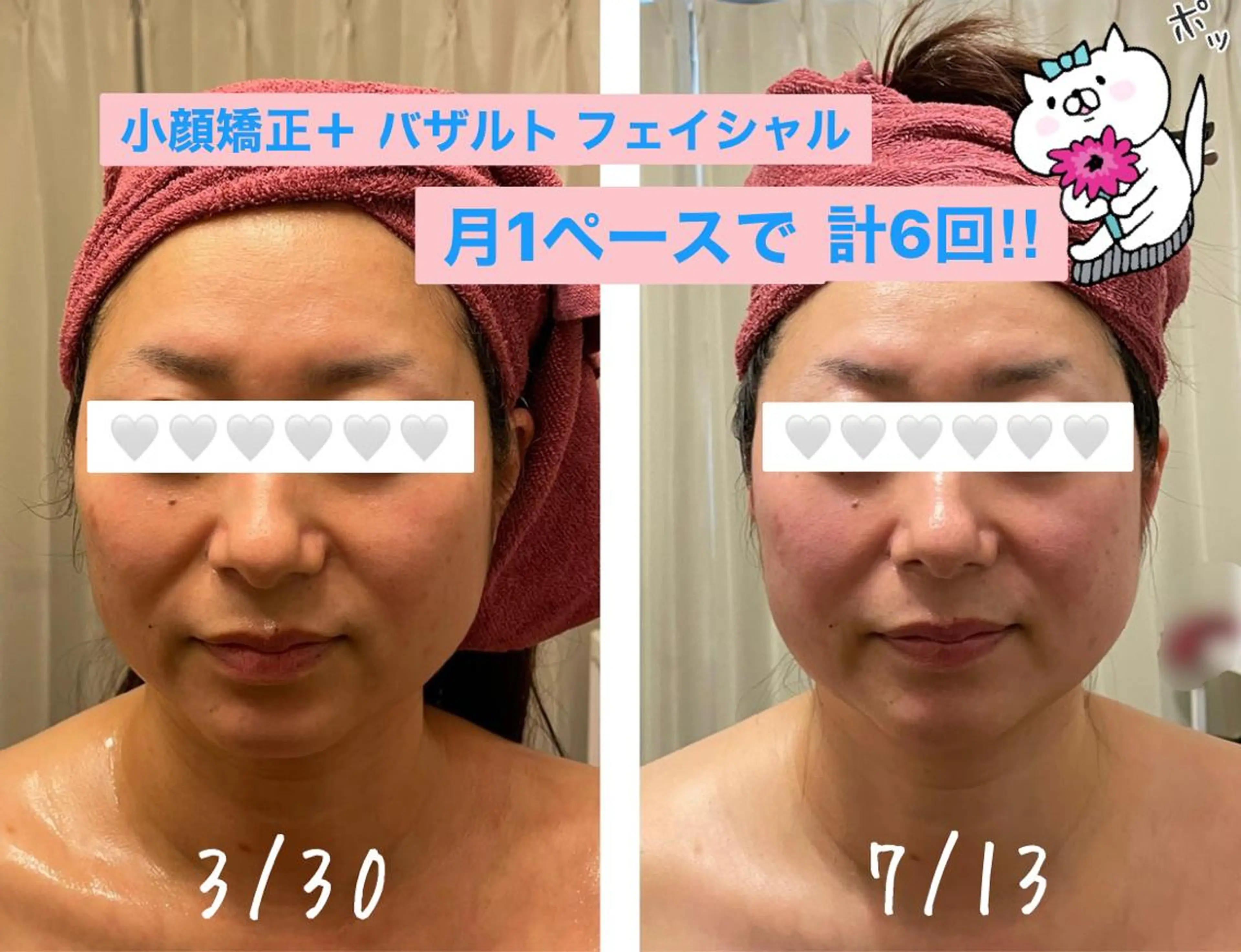 エステ 35歳からの エイジングケアサロンのエステ・リラクイメージ