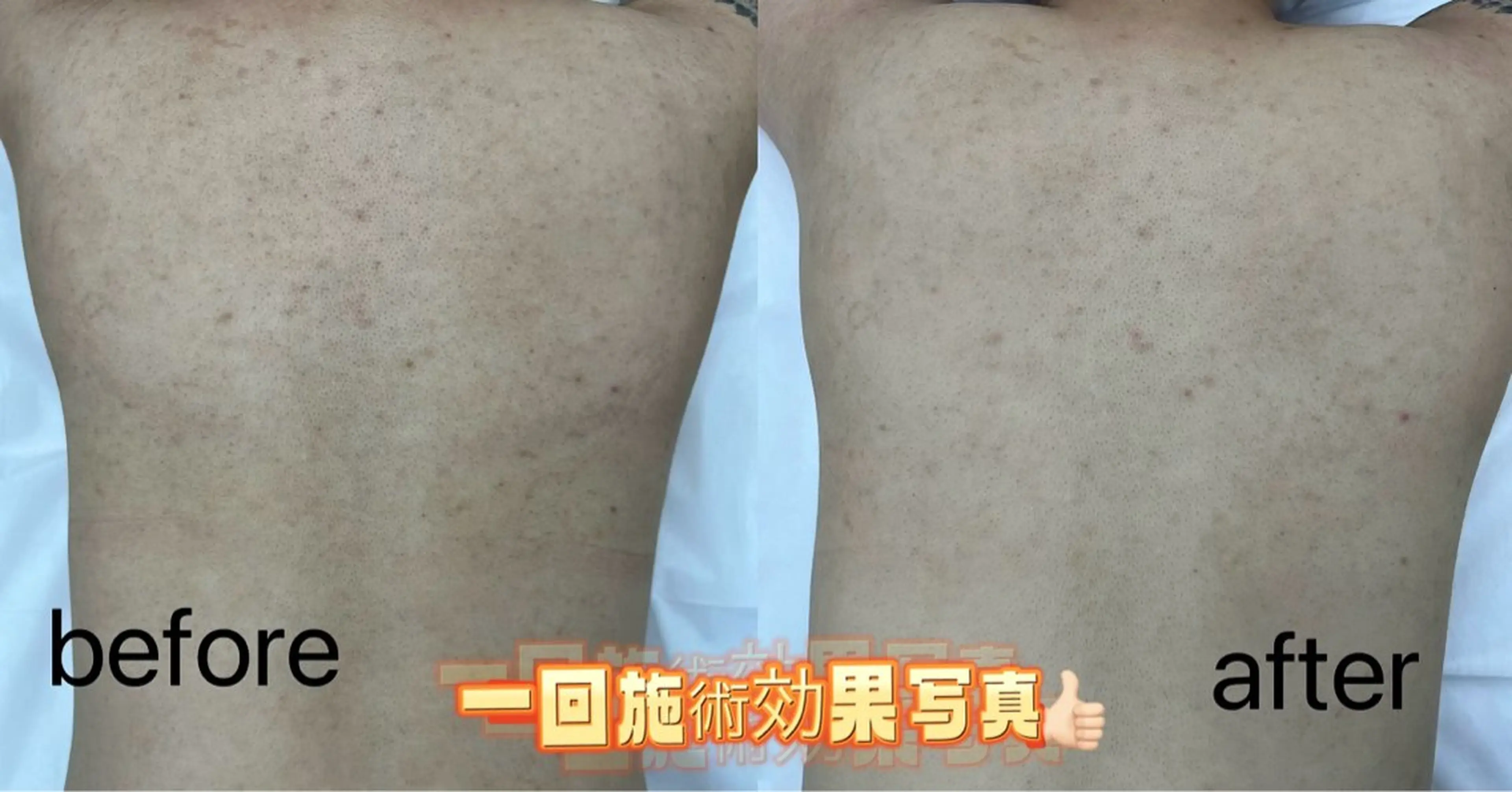 Nature Souce毛穴専門店のその他イメージ