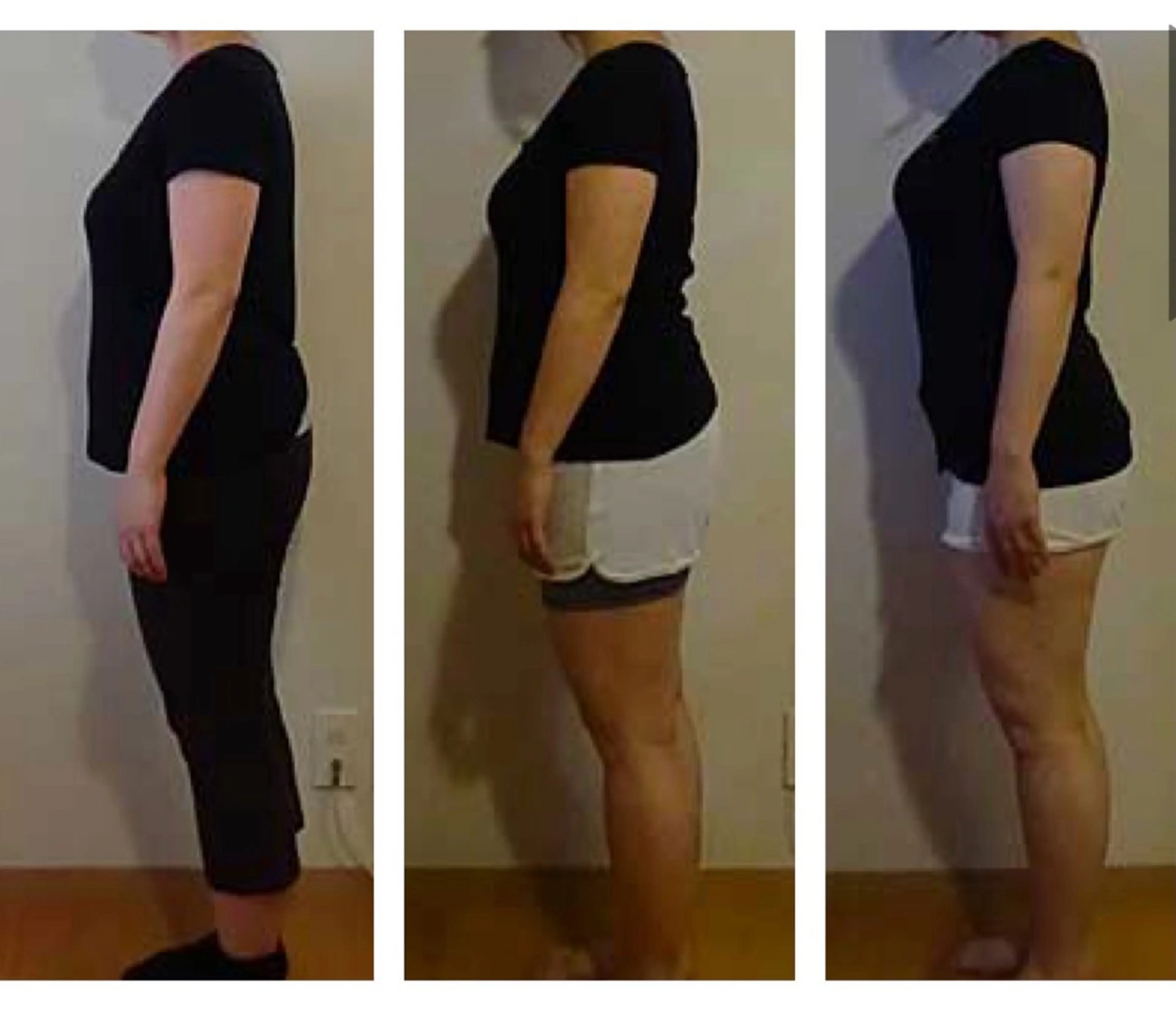 【集中ボディメイクコース】見た目年齢-5歳✨全4回⭐️見た目改善😍コースの写真