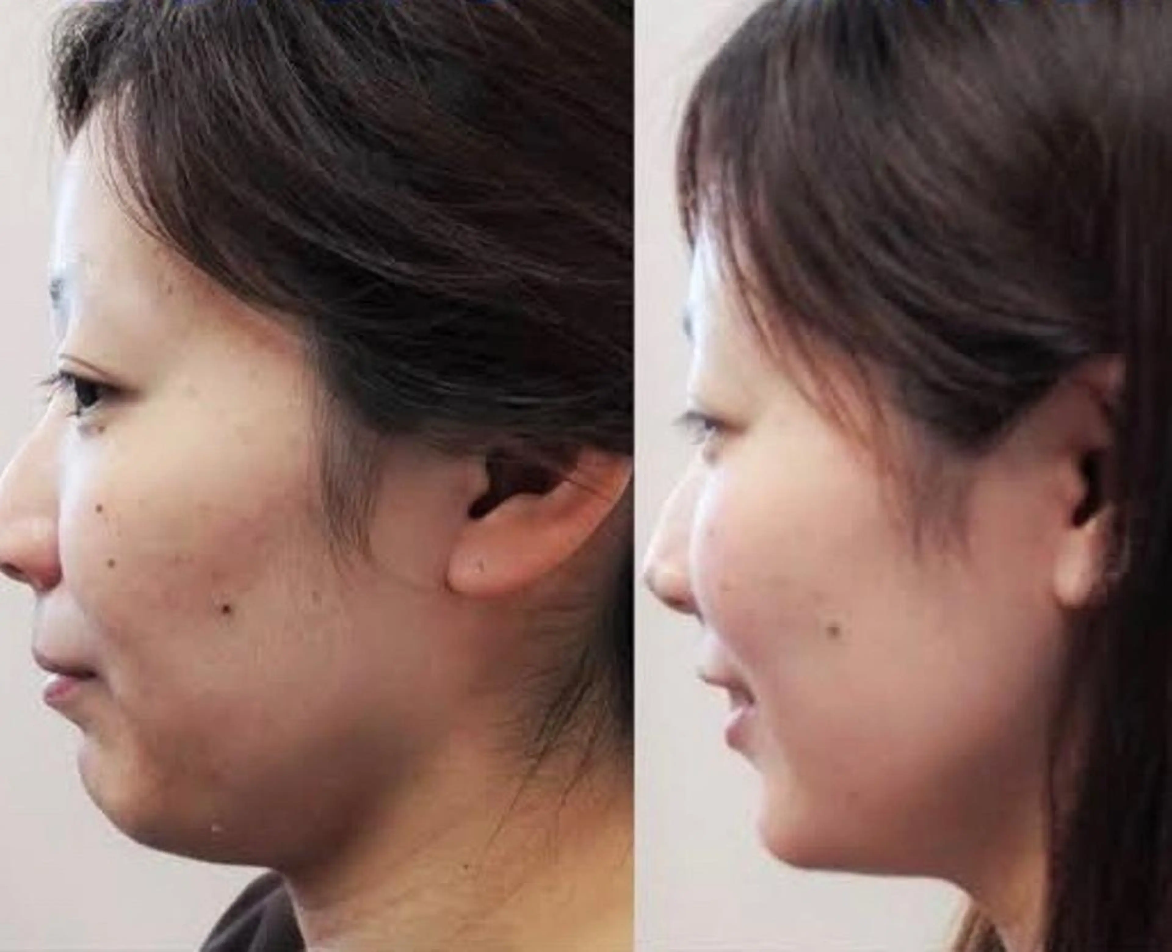 ミディアム カラー ネイル マツエク・マツパ 小顔矯正・美容鍼 美鍼堂のエステ・リラクイメージ