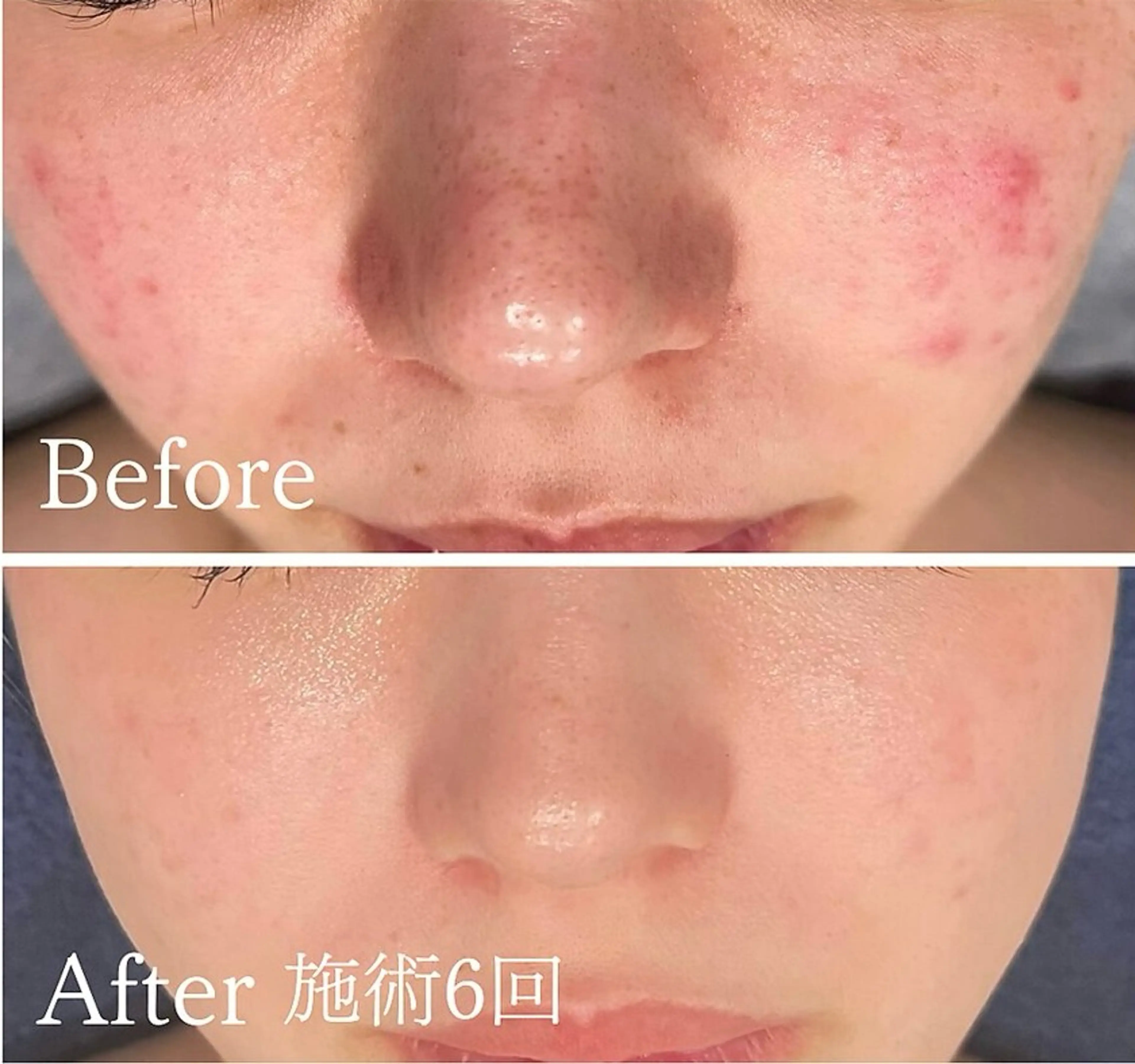 アンド ミルルのエステ・リラクイメージ