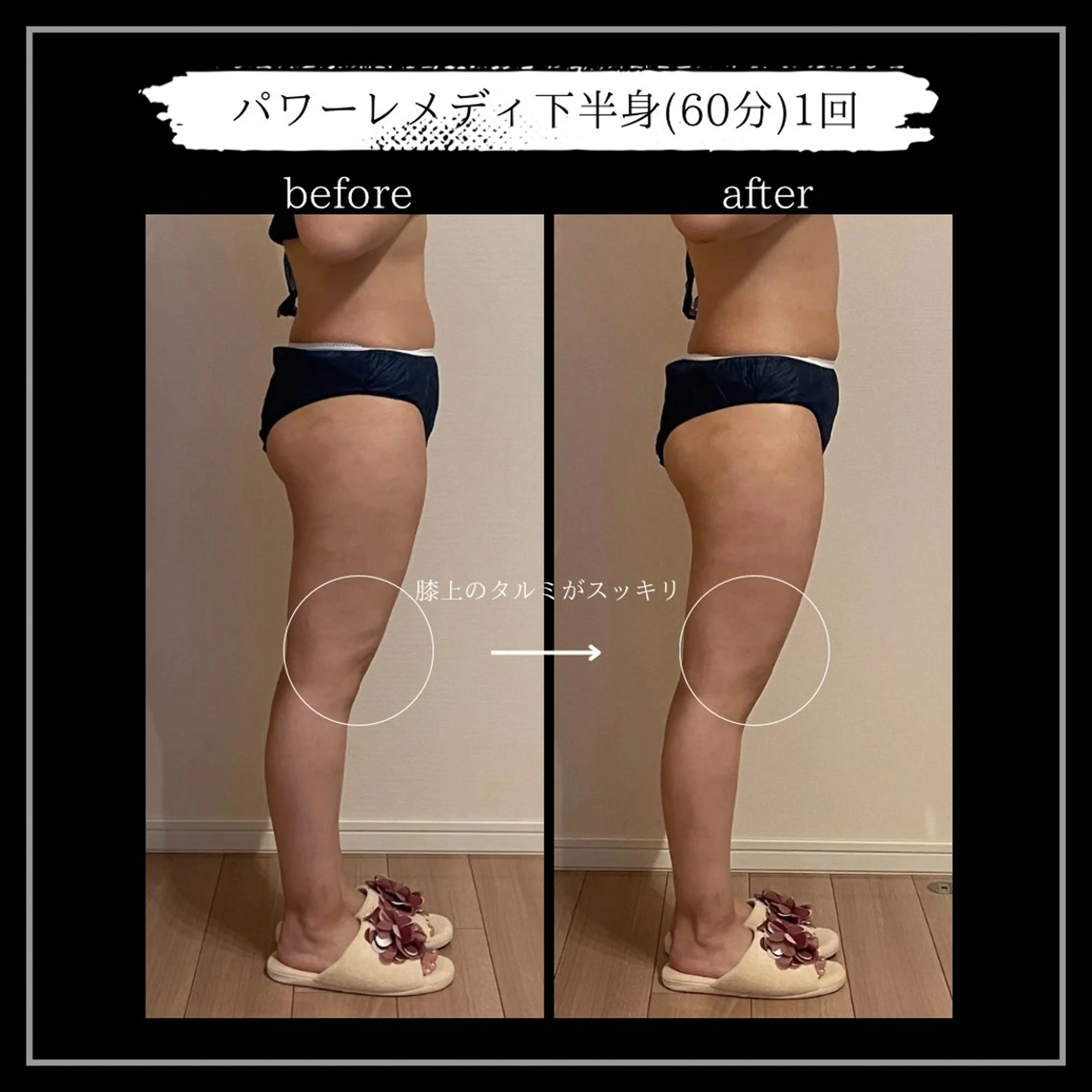 オフ:オン 全身筋膜マッサージのエステ・リラクイメージ