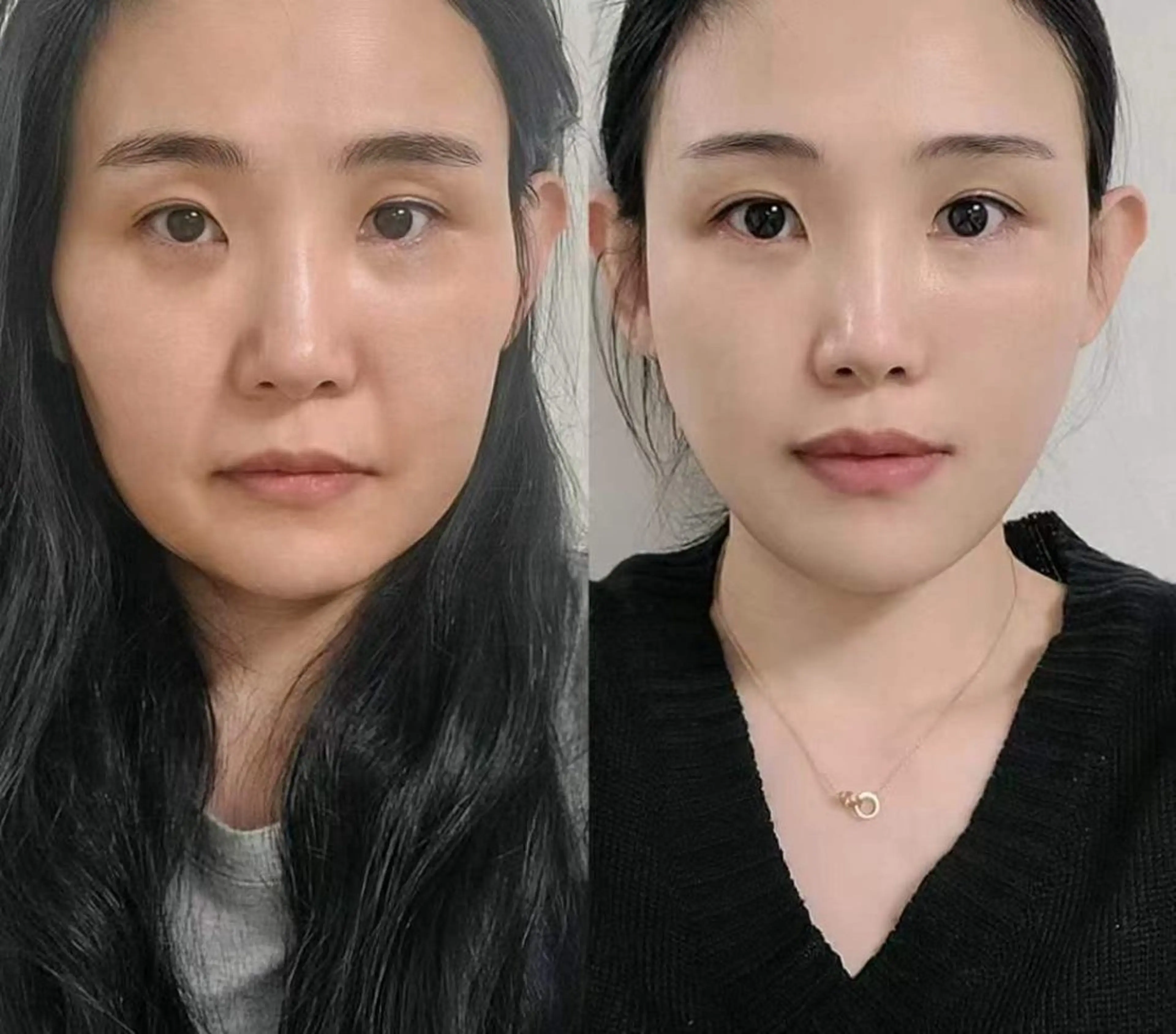 マツエク・マツパ 結婚式・ブライダル エステ aliaハーブ水光店 エステティシャン募集のエステ・リラクイメージ