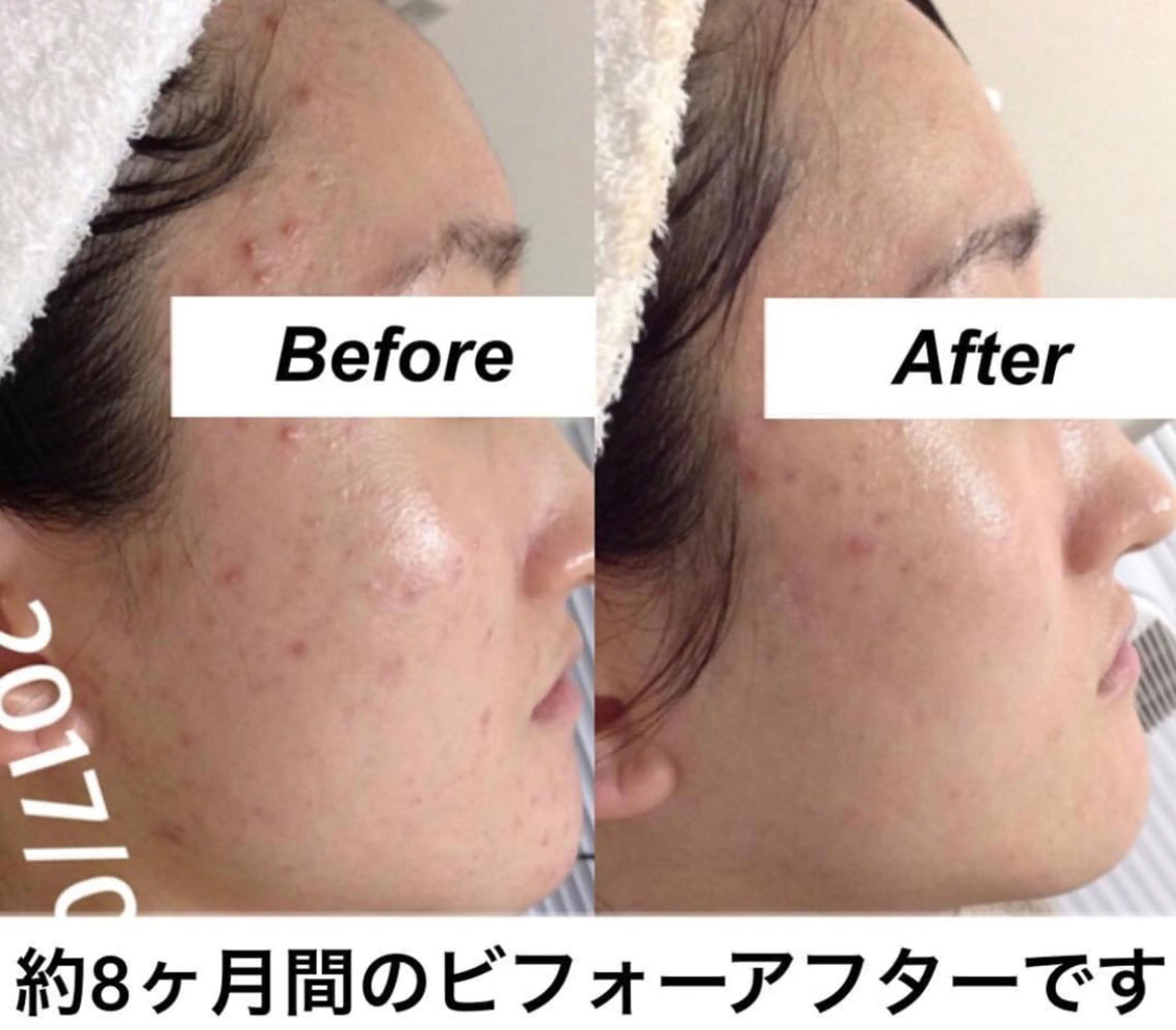 エステ リラク 都度払い肌質改善 &脱毛Blancheのエステ・リラクイメージ