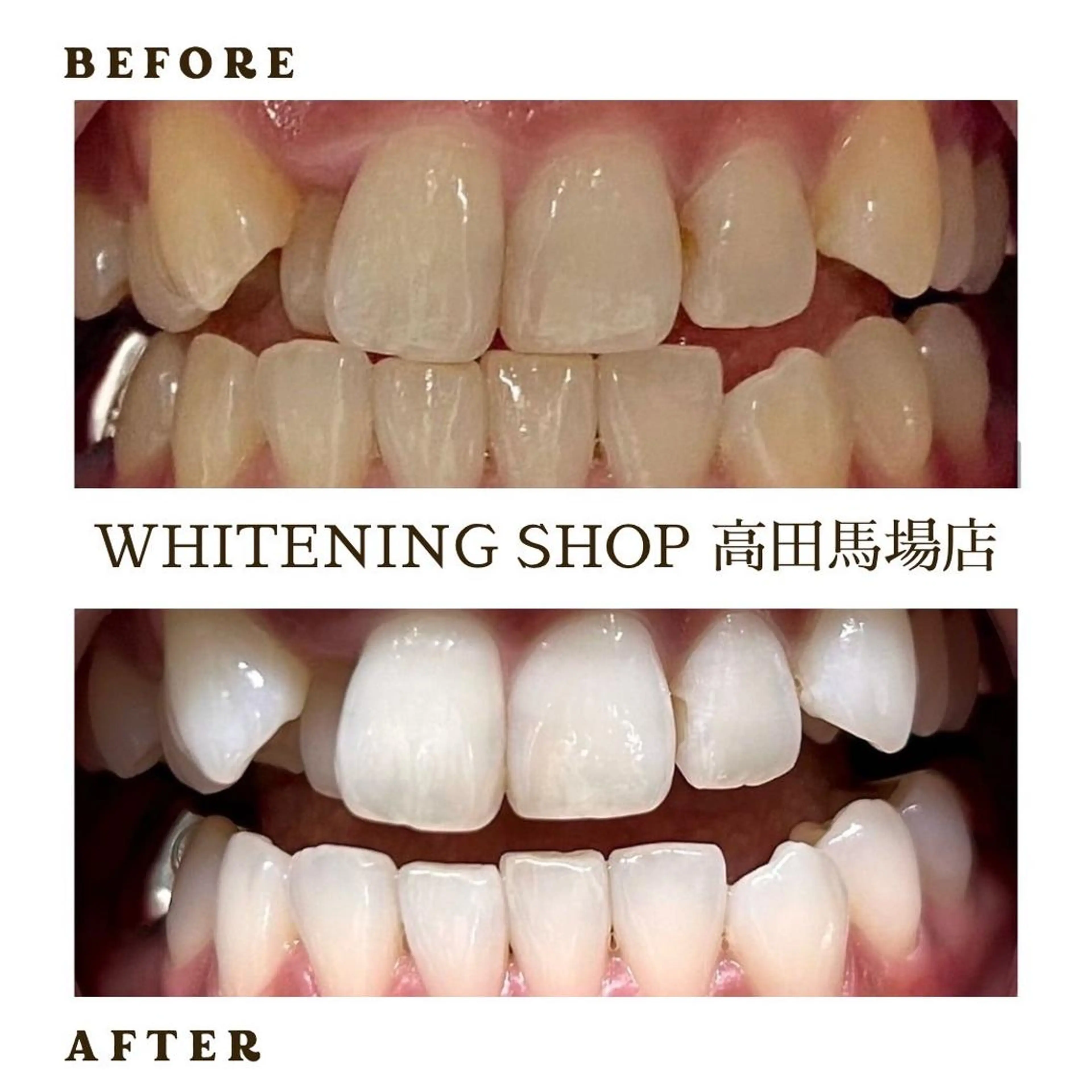 メンズ その他 ホワイトニング ショップ高田馬場店のその他イメージ