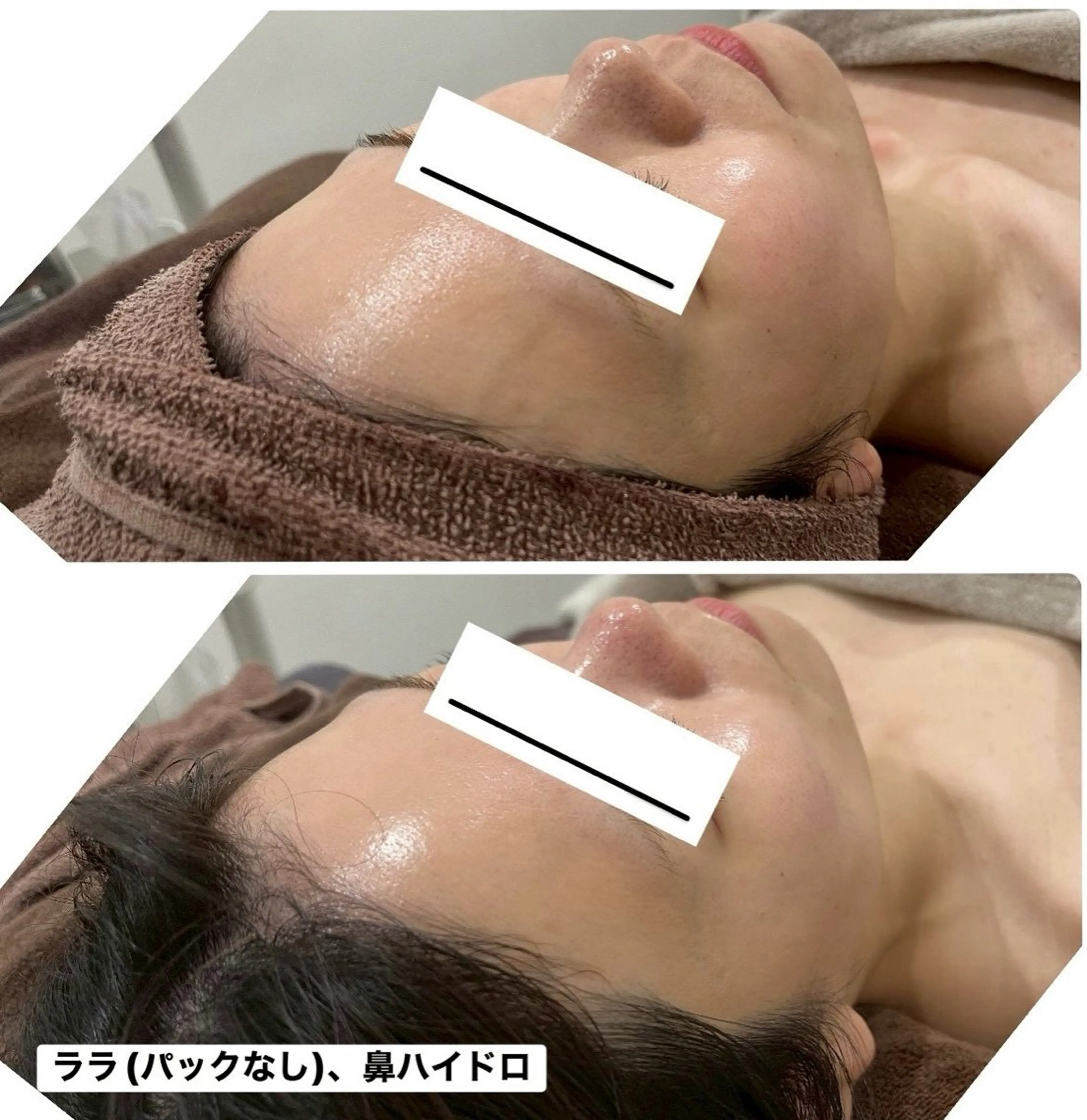 【韓国式美肌】大人気ララ💗写真okモニターの写真