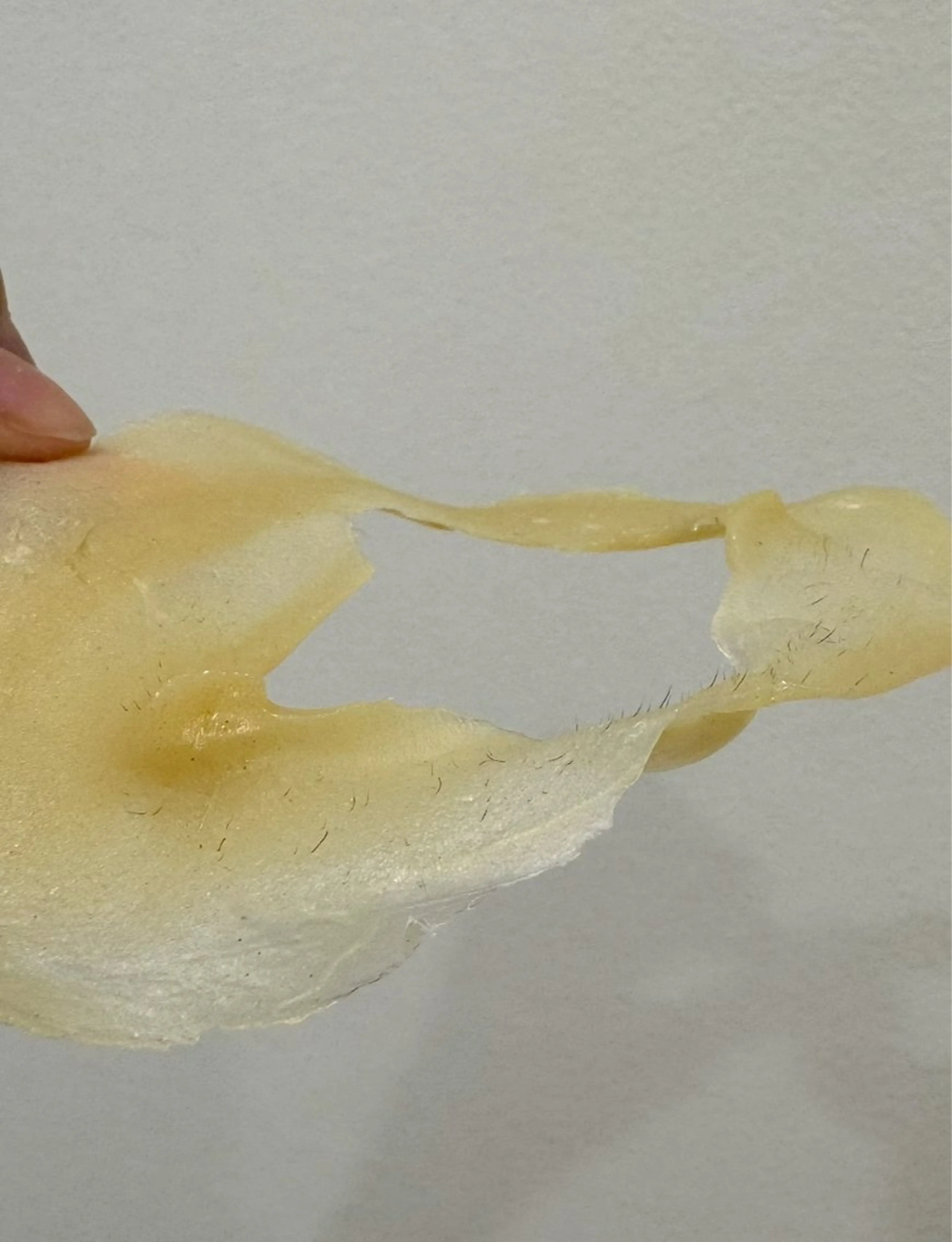 毛穴開き黒ずみ ニキビ特化💆‍♀️のエステ・リラクイメージ