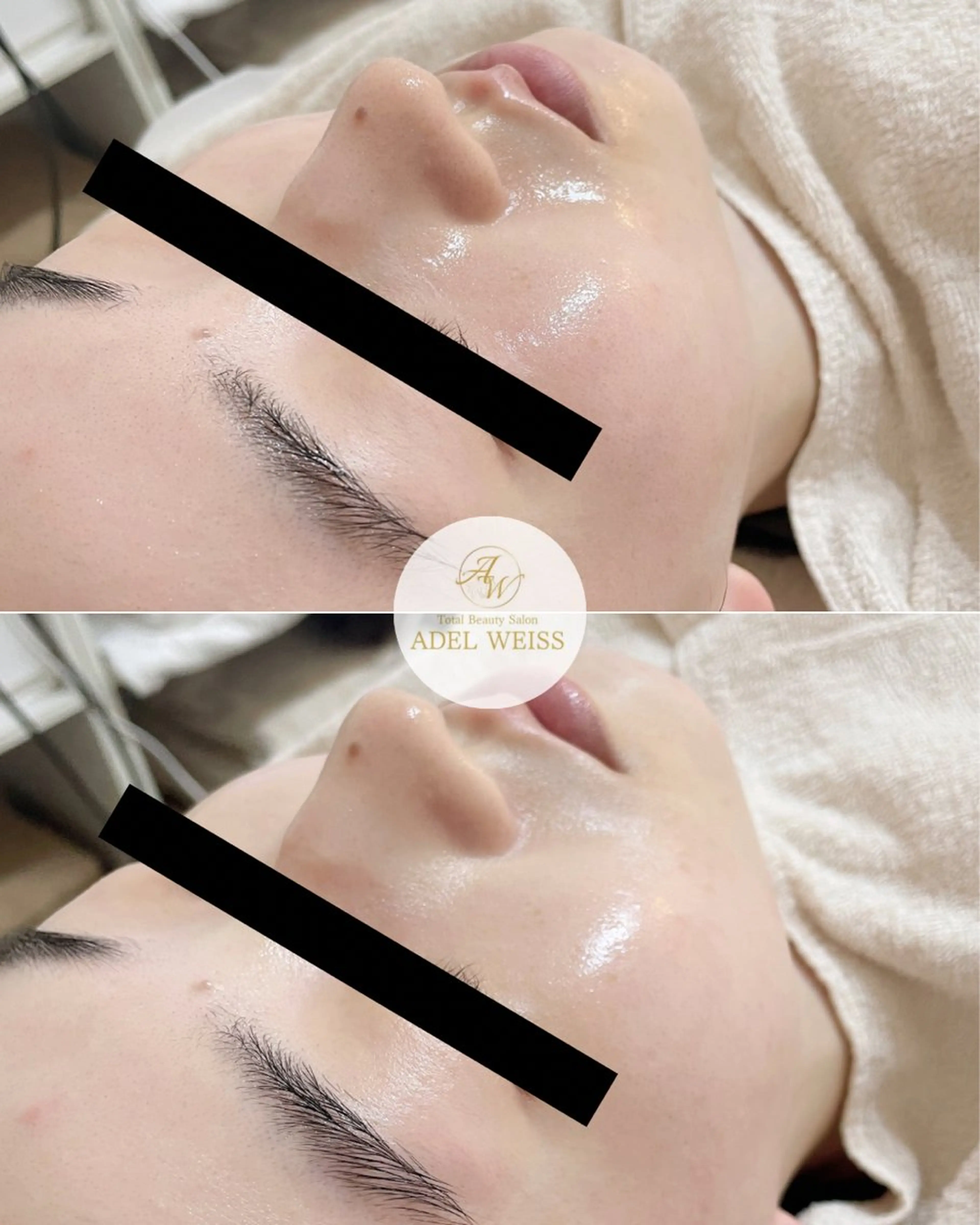 エステ ADEL WEISS 脱毛＆毛穴＆リンパのその他イメージ