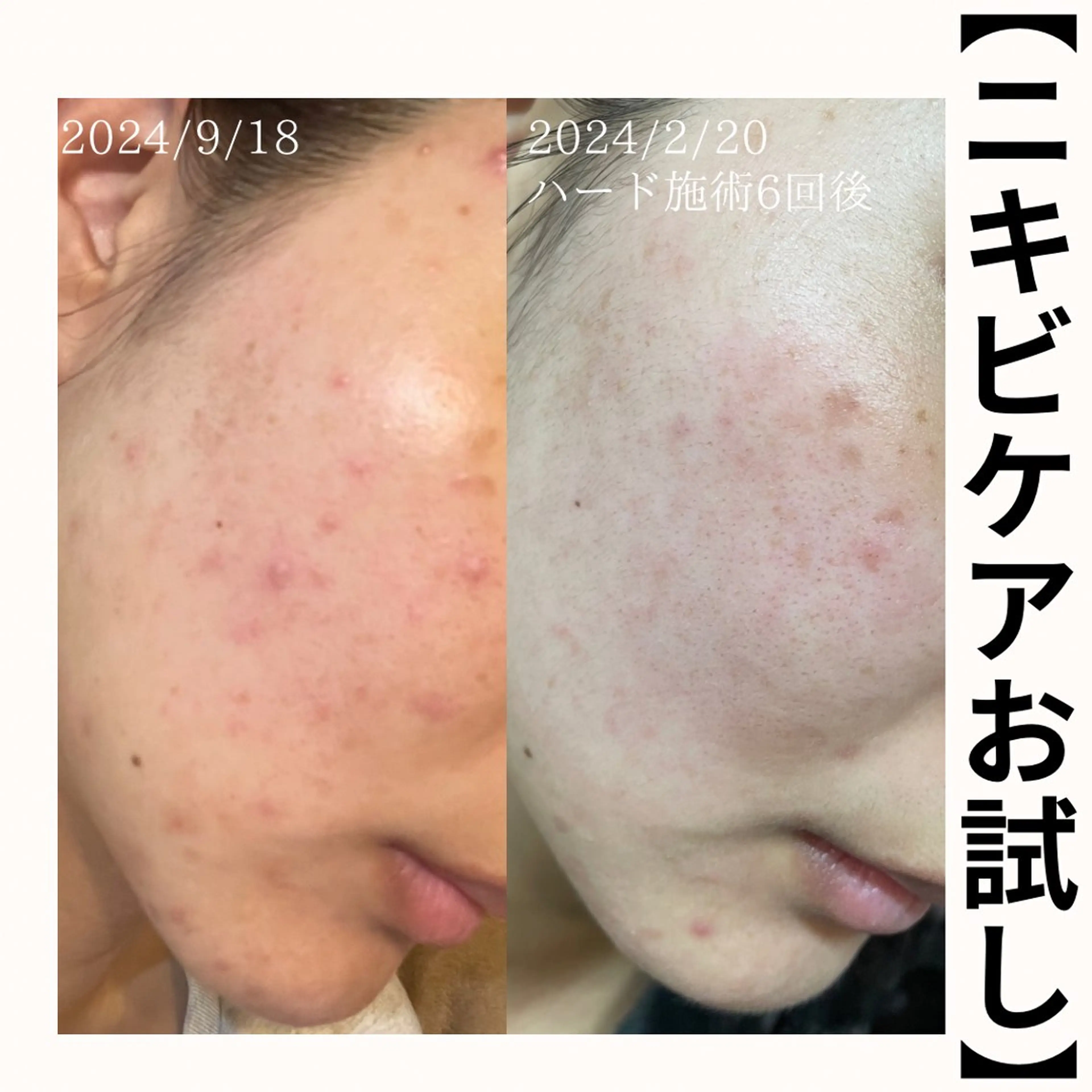 毛穴改善サロン d'Alba大阪住吉のエステ・リラクイメージ