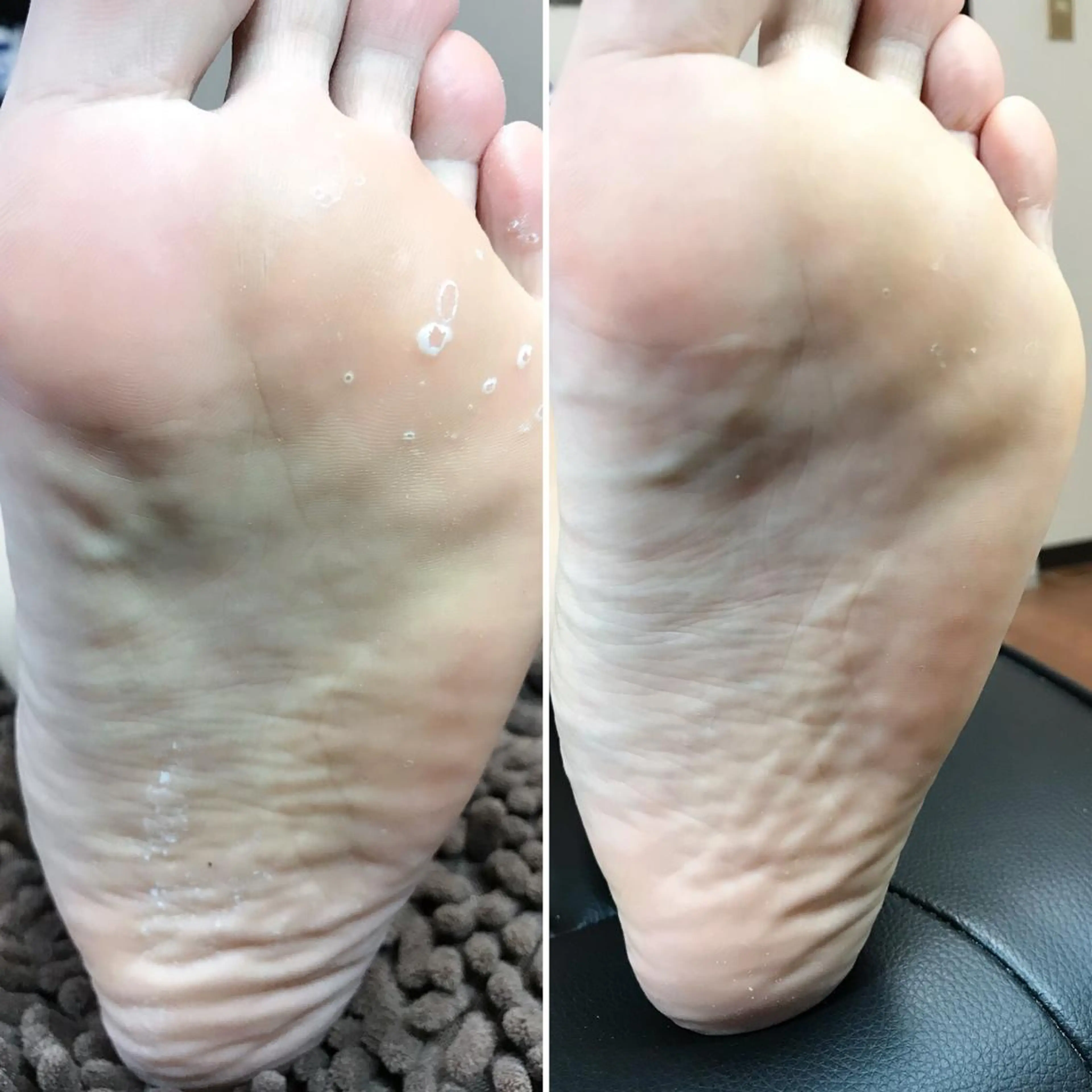 ネイル メンズ歓迎🙆‍♀️ エステ/ネイルISTのネイルデザイン