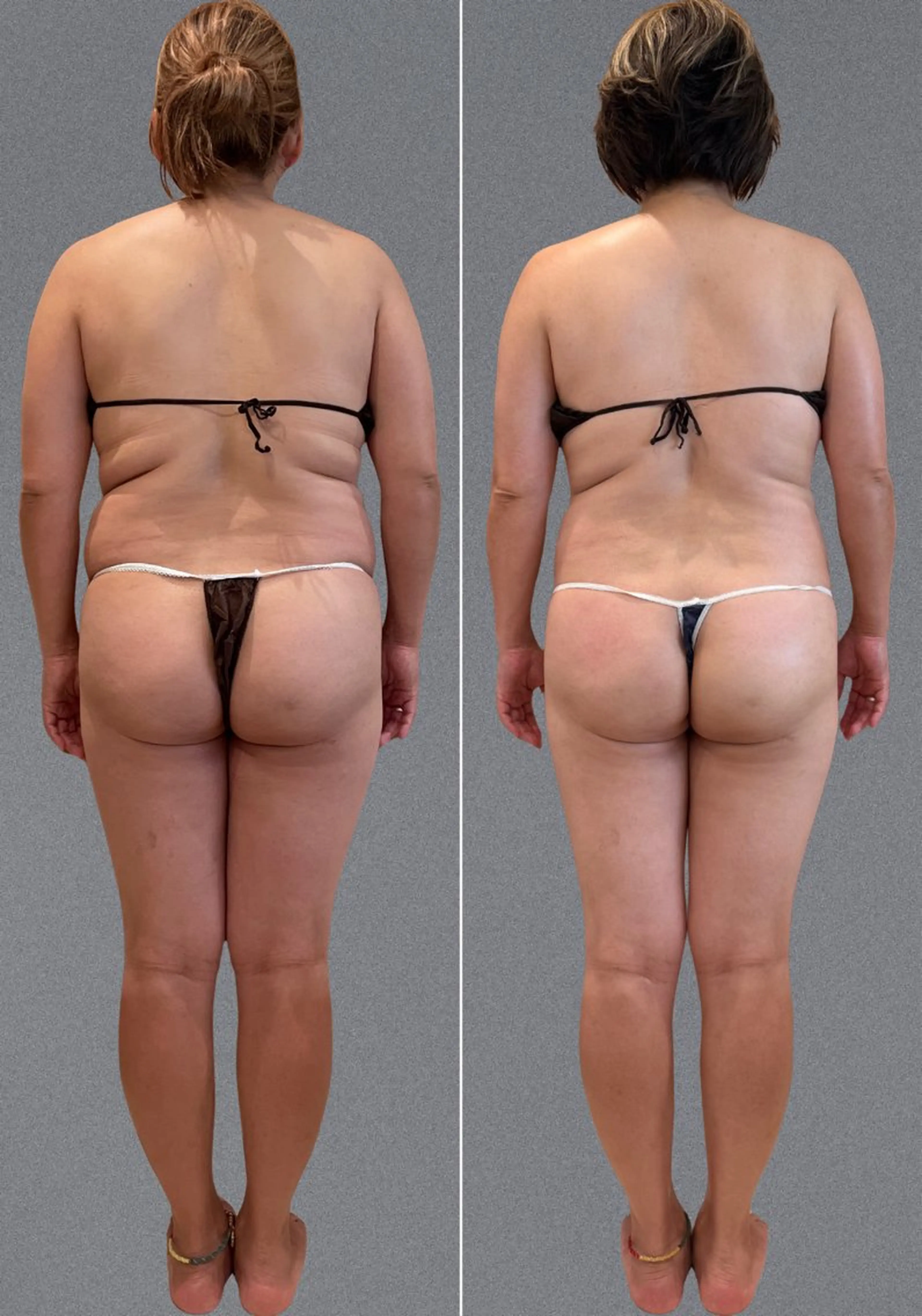 エステ リラク 鈴木 ひろこのエステ・リラクイメージ