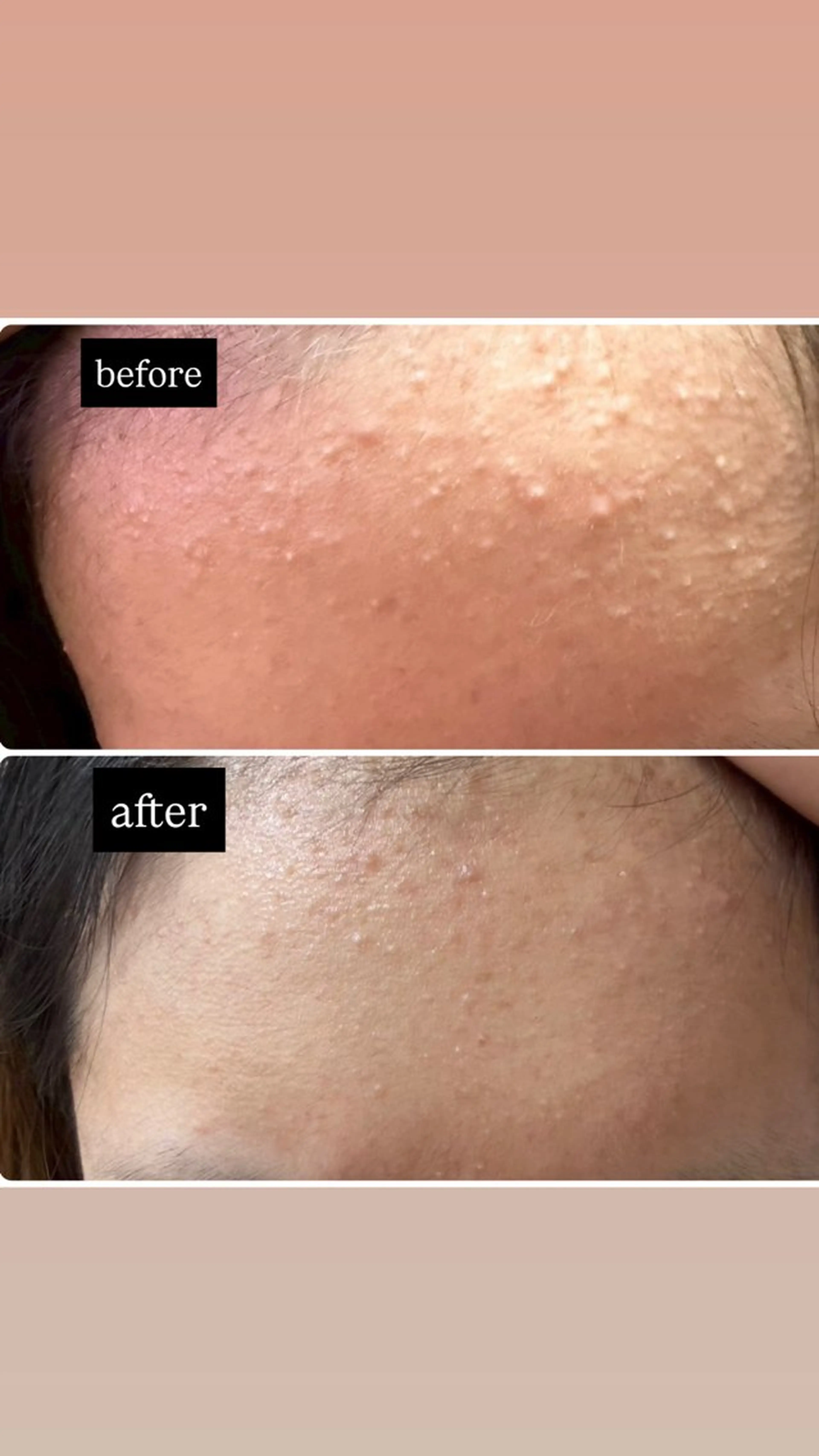 キッズ エステ 美と健康サロン Lino leaのエステ・リラクイメージ