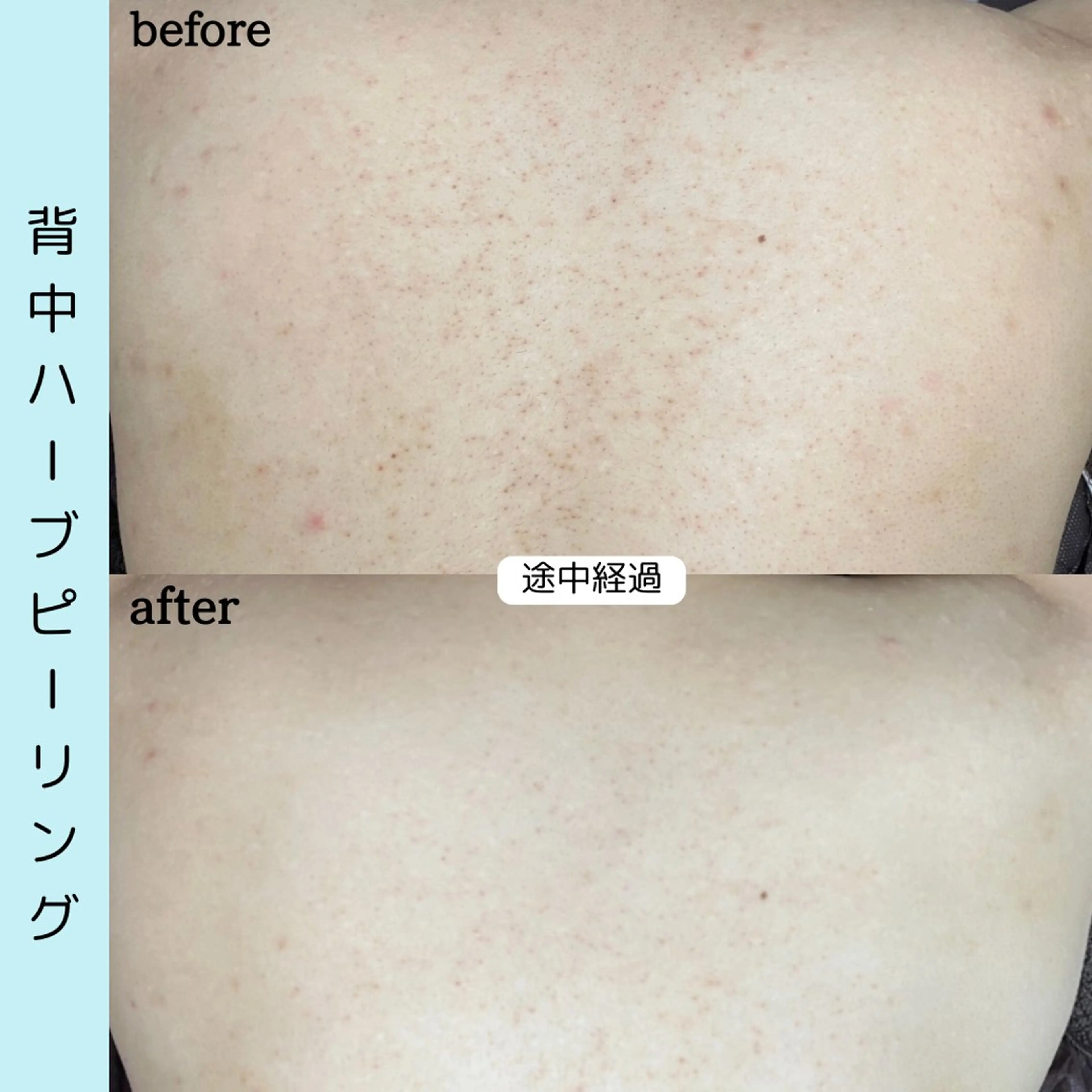 エステ ベラージュ【美背中・ 美尻・フェイシャル】のエステ・リラクイメージ