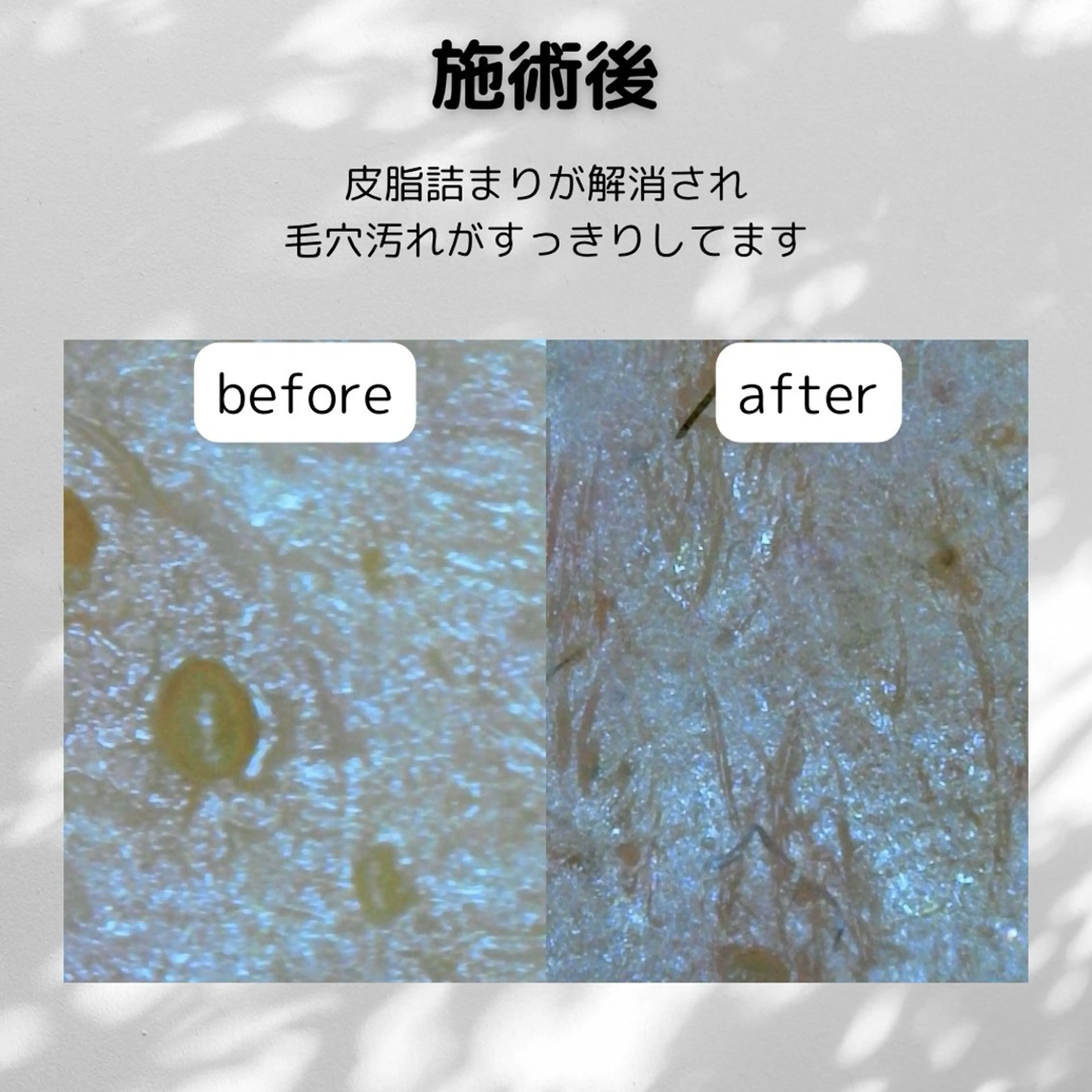 エステ 🌿hitomi🌿 艶肌/肌質改善のエステ・リラクイメージ