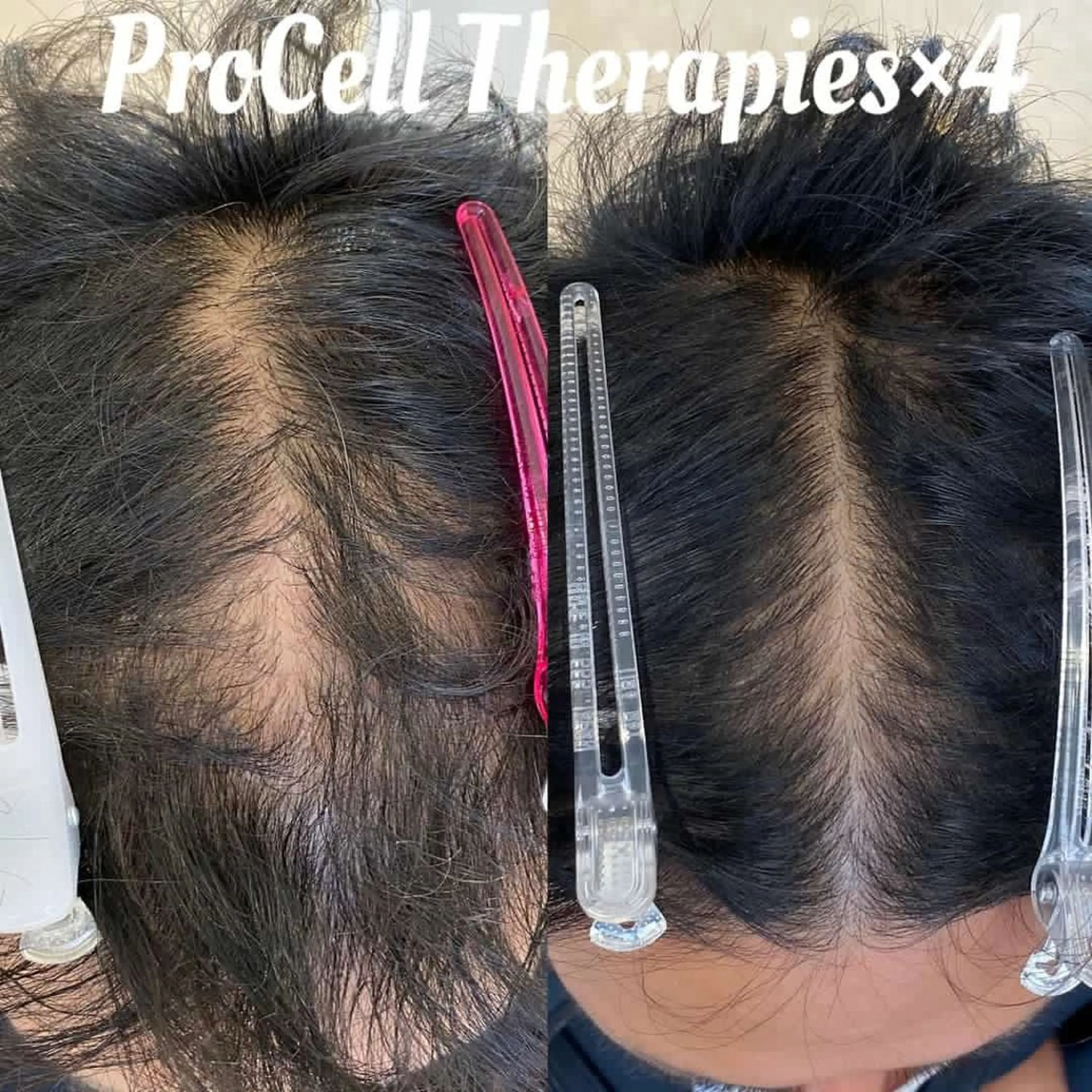 Blooming所属・LOUISE. ／肌質・頭皮のエステ・リラクイメージ