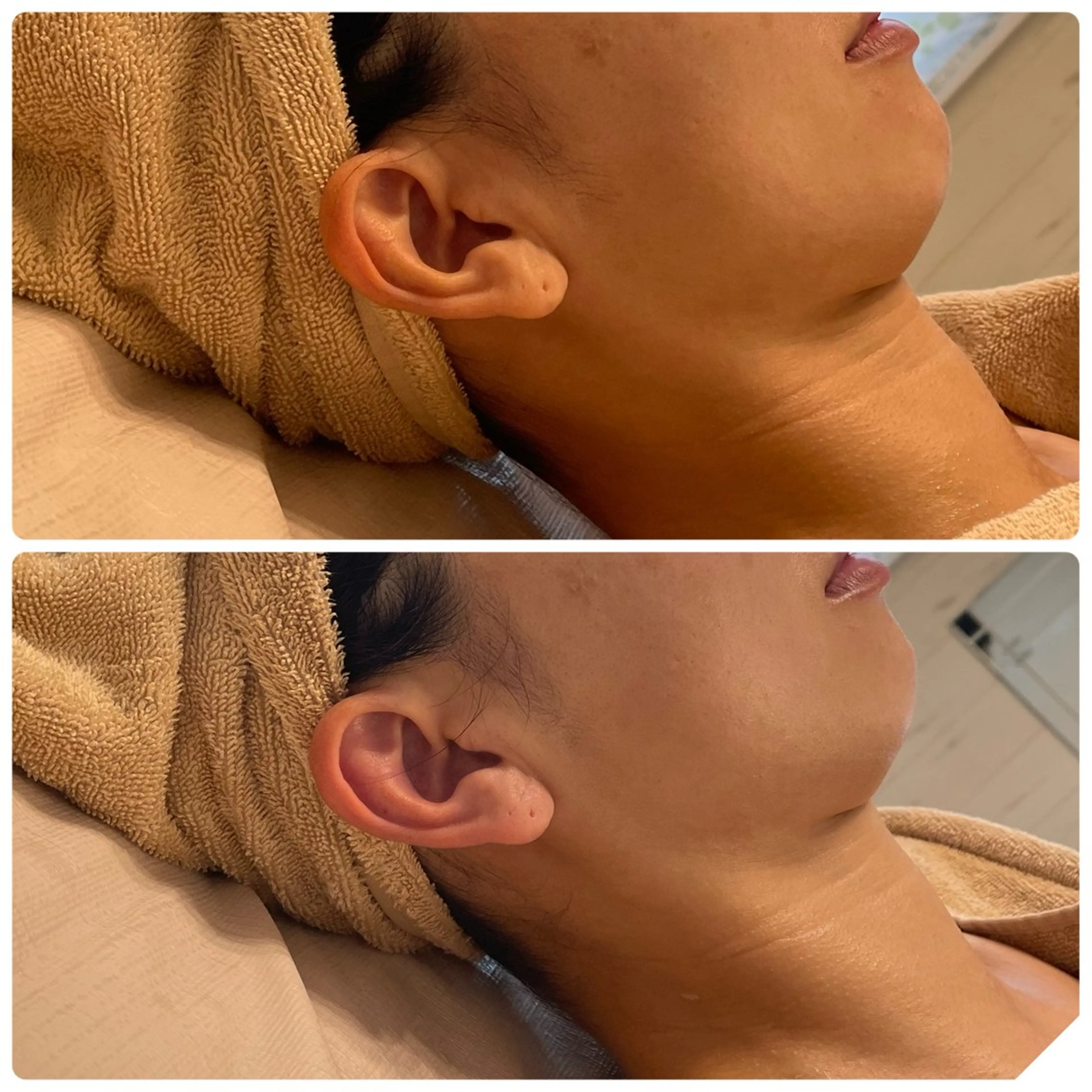 エステ リラク 小顔・たるみケア✨ フェイシャル&ボディのエステ・リラクイメージ