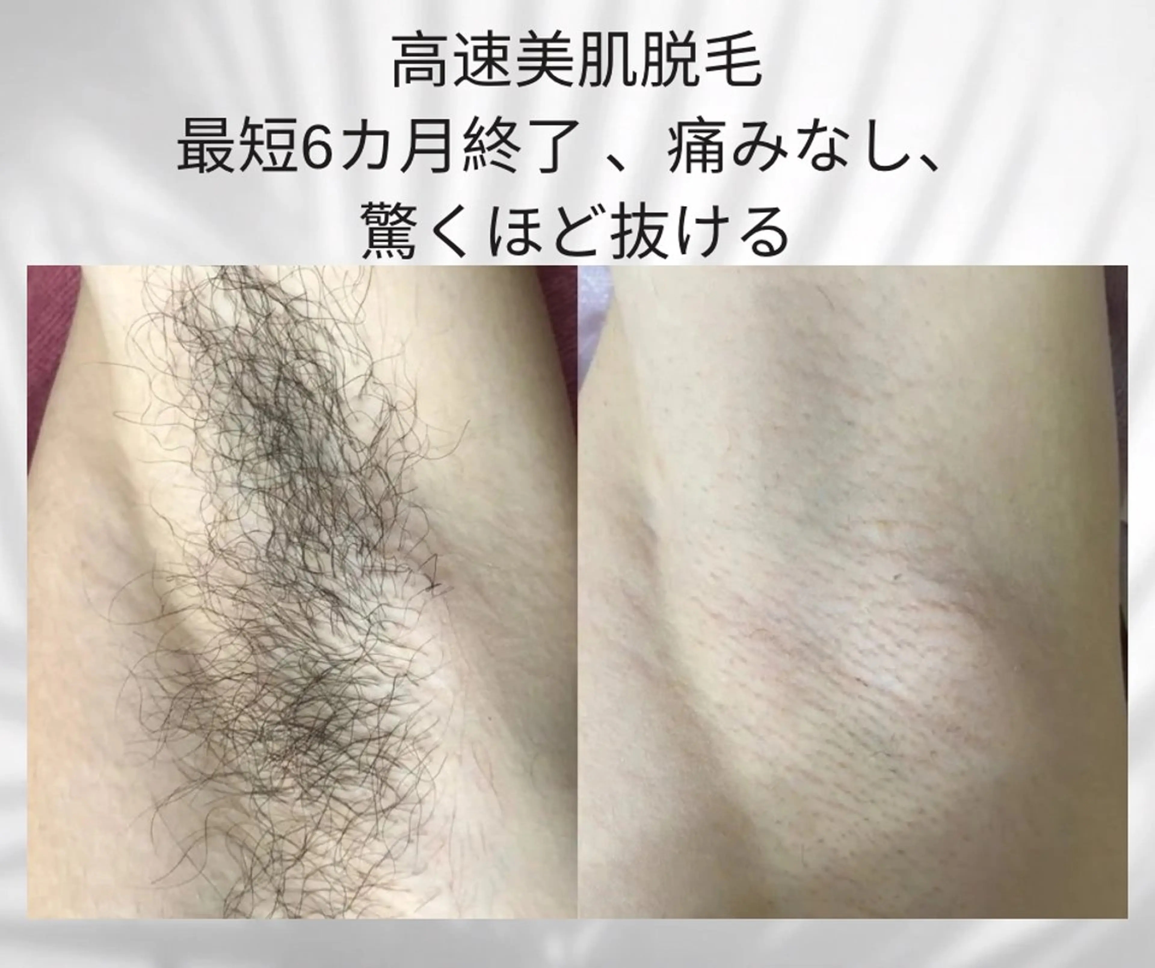 美肌，美ボディ，脱毛 サクラチャンスパのエステ・リラクイメージ