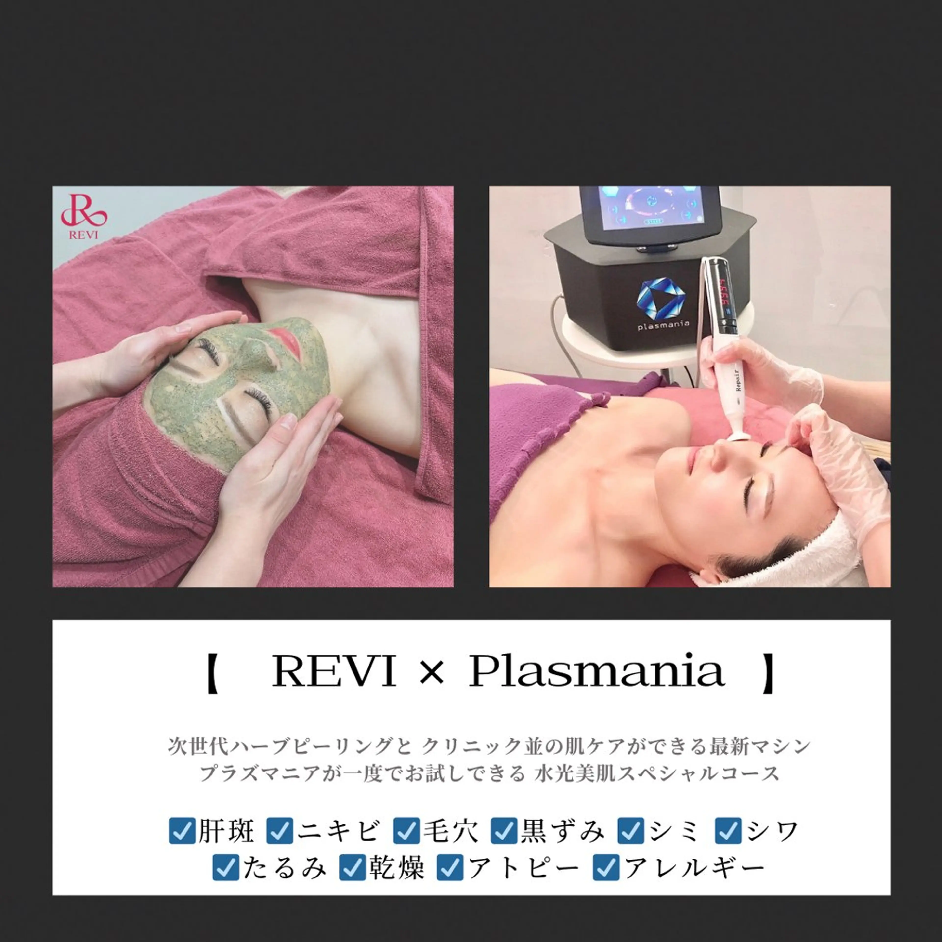 エステ Bevi salonのその他イメージ