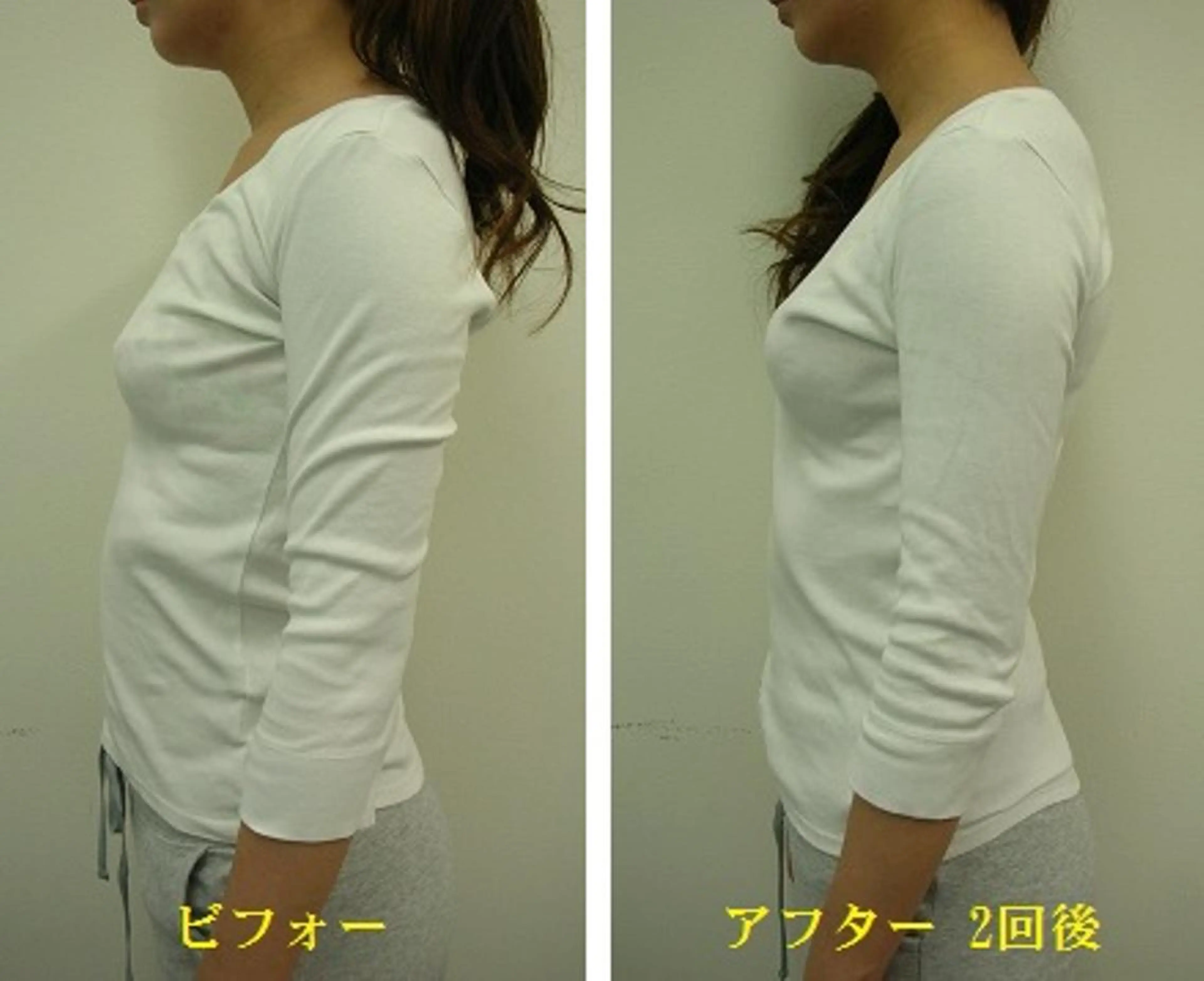 肋骨矯正(ろっ骨矯正)専門施術　通常初回9,400円→4,980円現金限定の写真