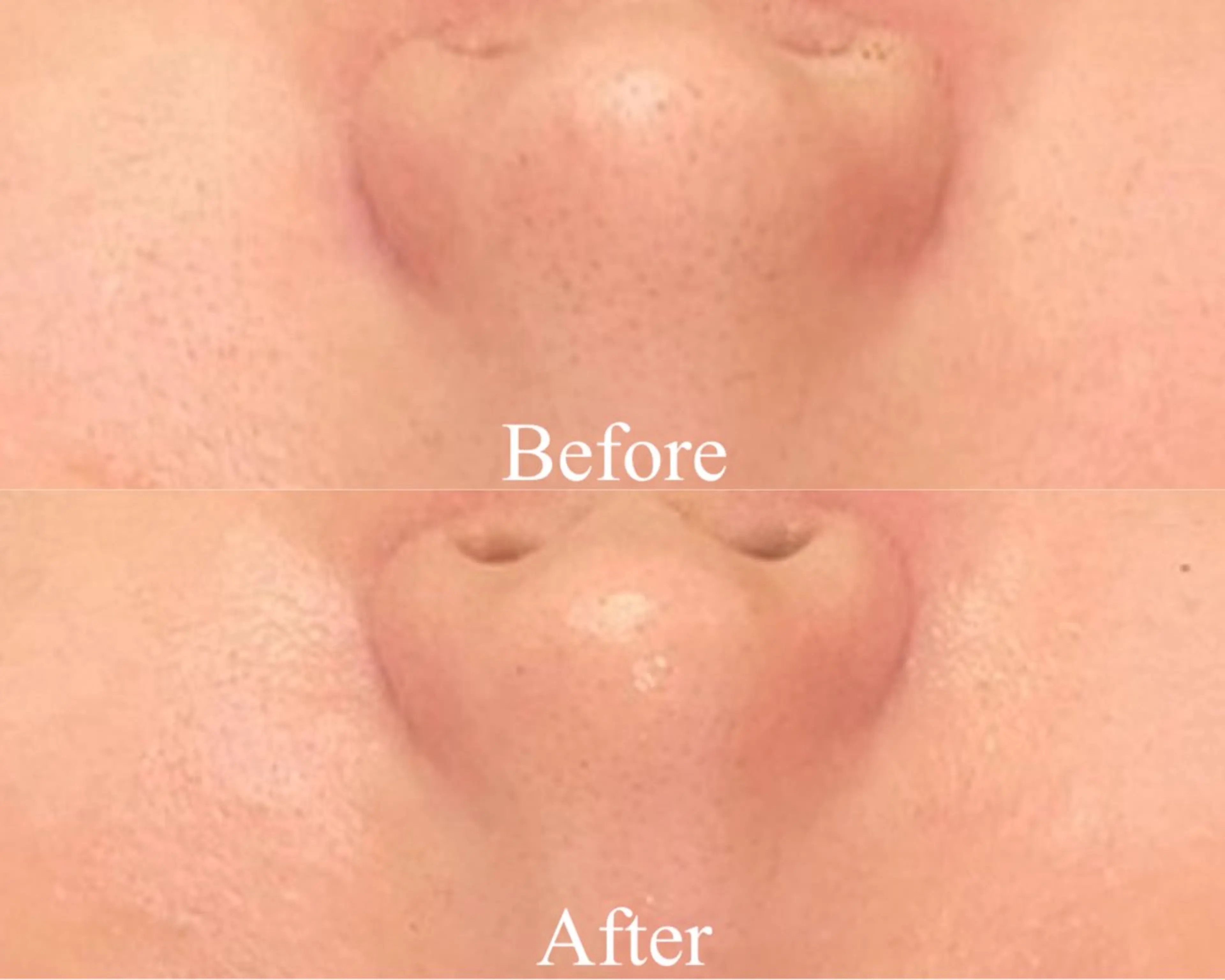 エステ Ginza Charerのエステ・リラクイメージ