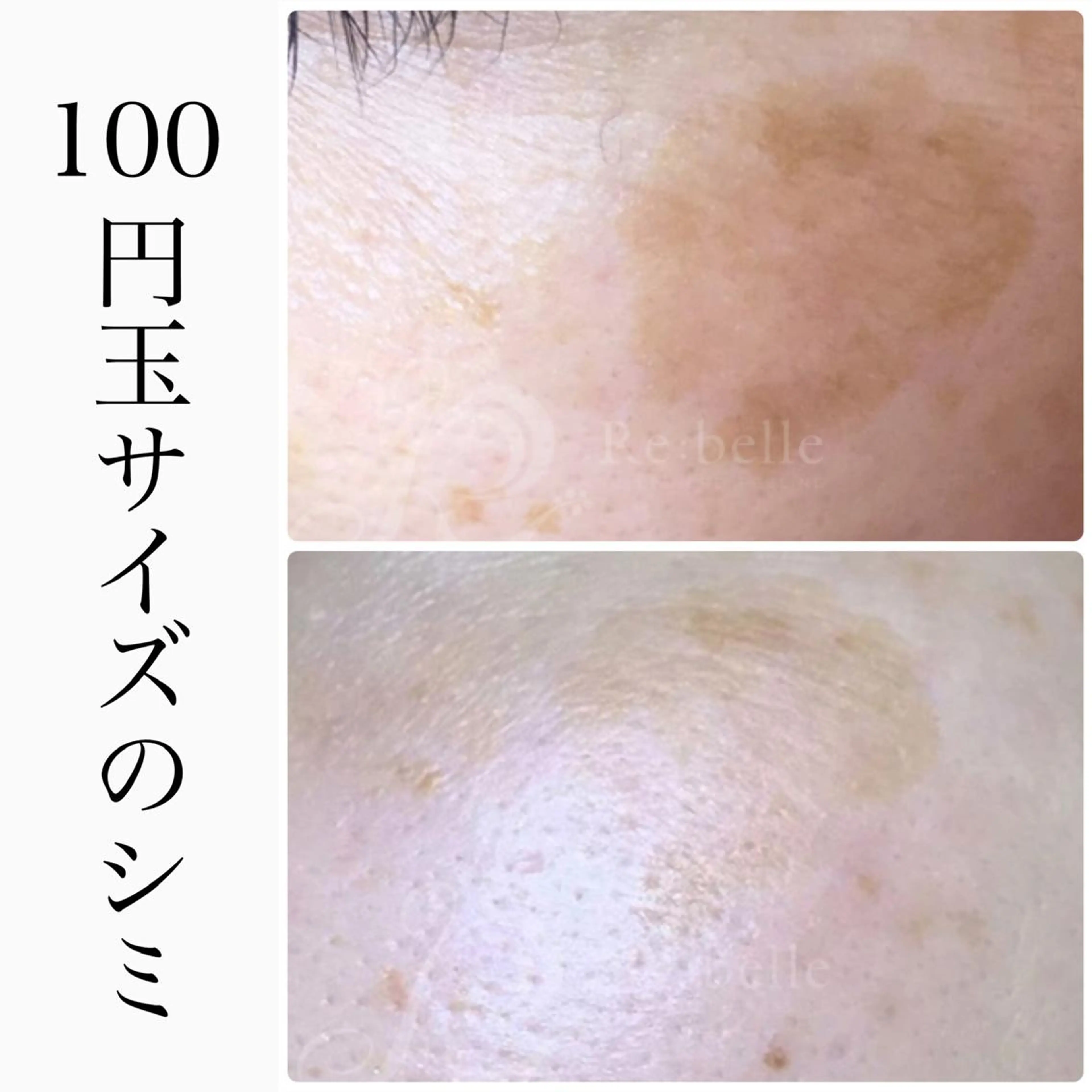 エステ ハーブピーリング専門 BIOEL横浜のエステ・リラクイメージ