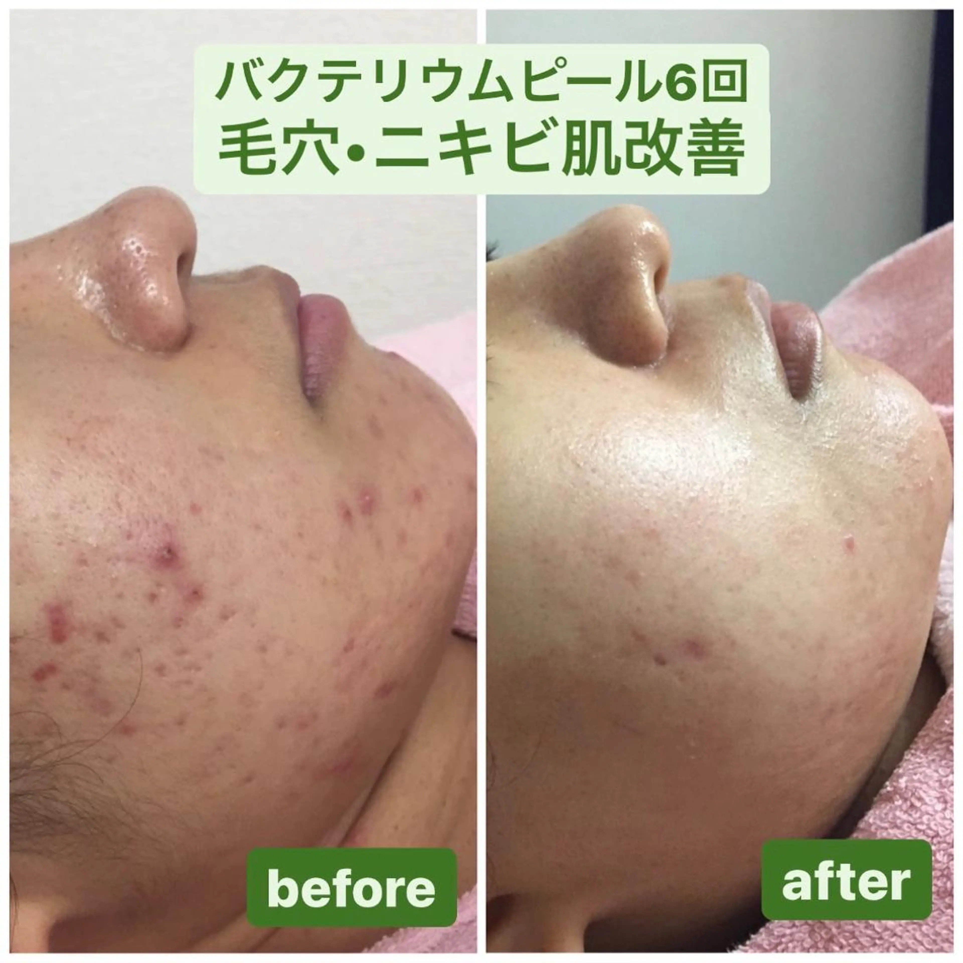 Linomalie エステ/たるみ/脱毛のエステ・リラクイメージ