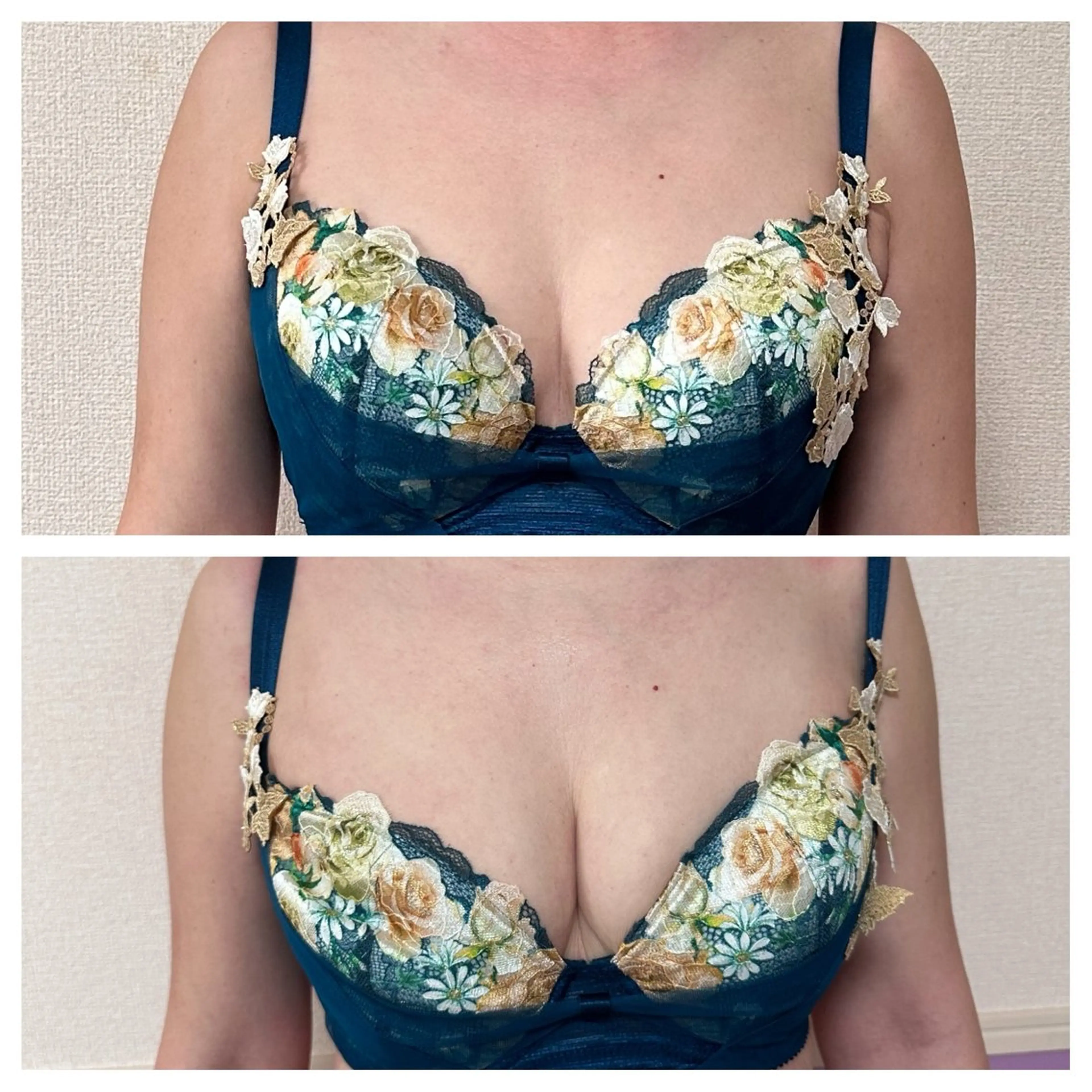 エステ Miel所属・バストアップサロン Mielのエステ・リラクイメージ