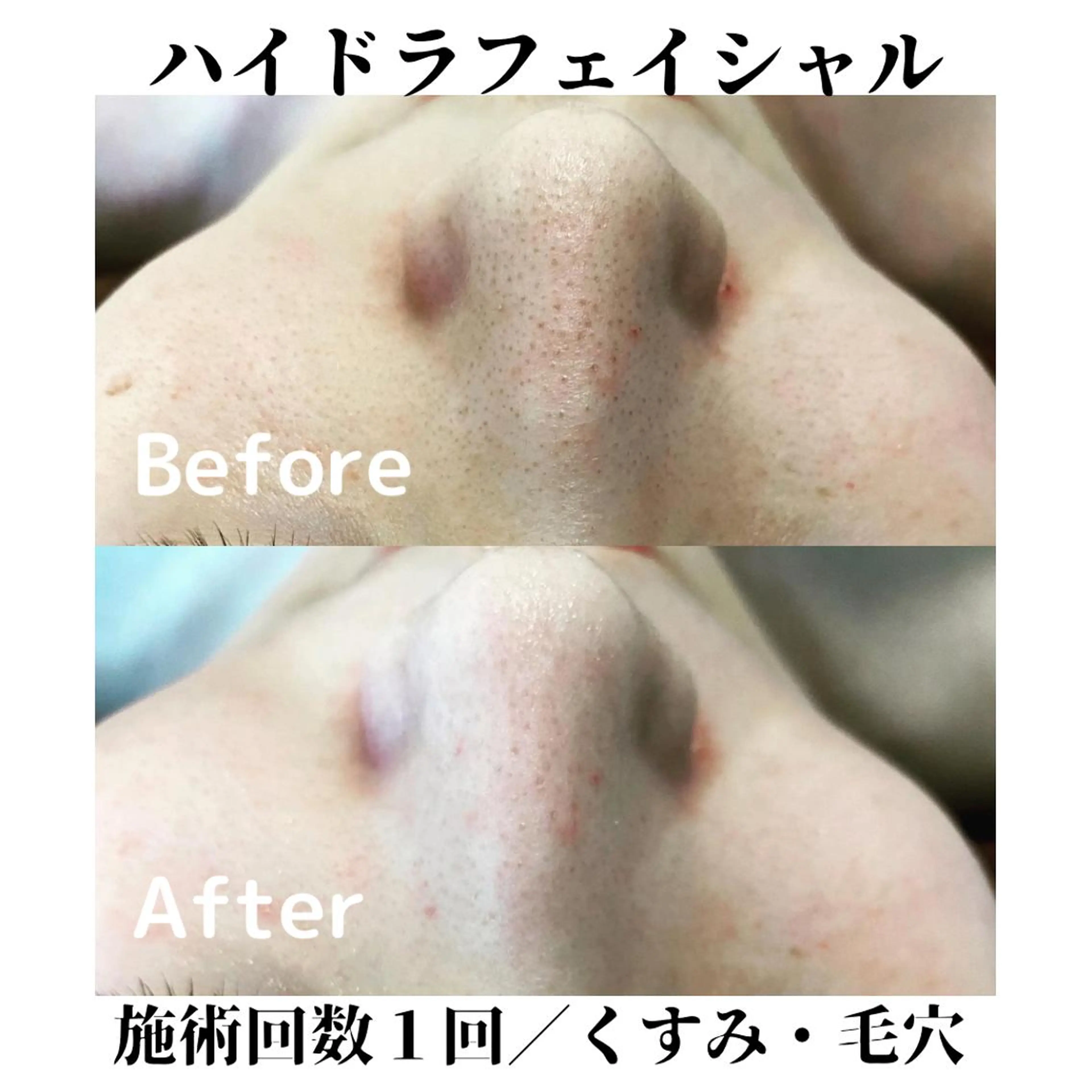 トータルビューティー サロンSalaのマツエク・マツパデザイン