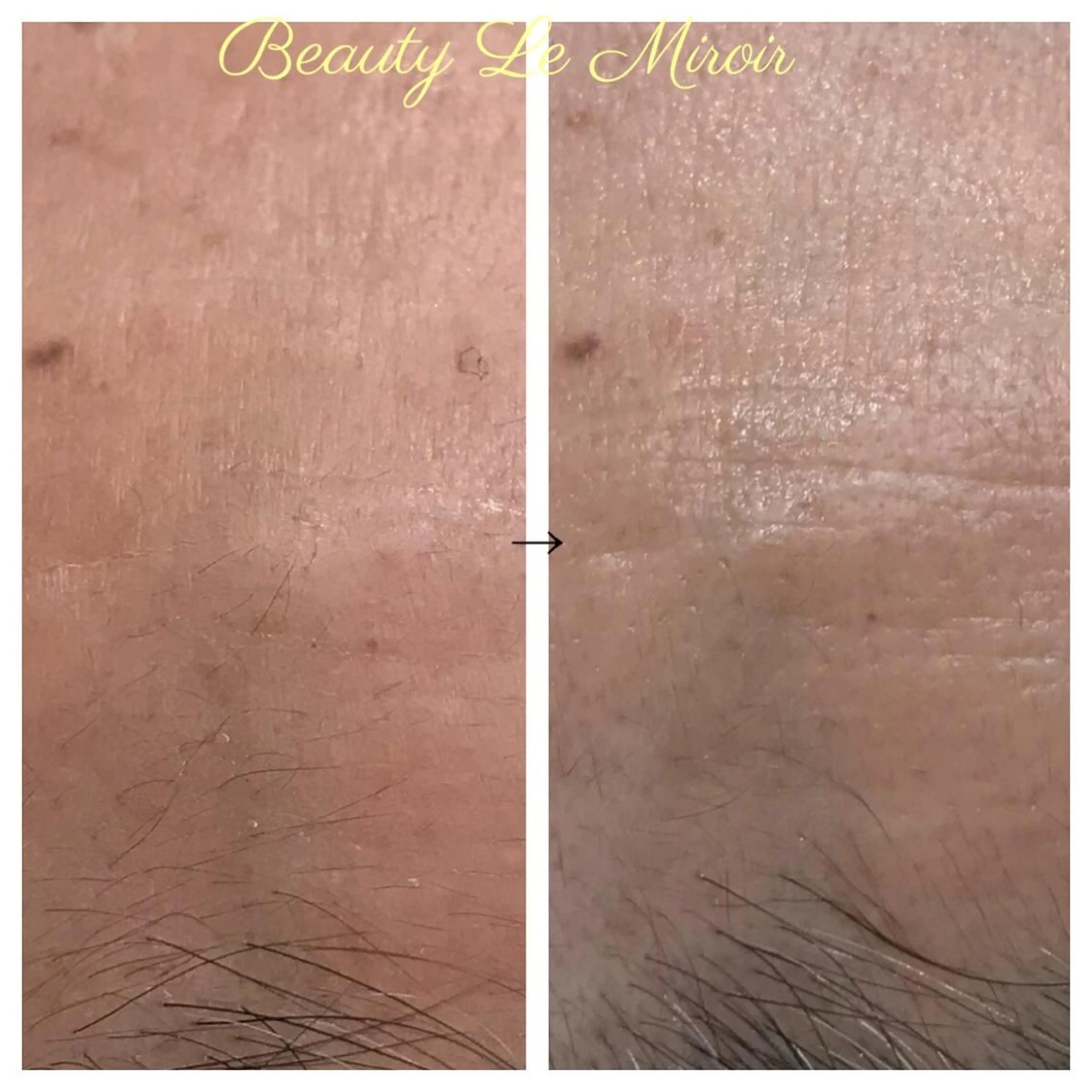 ビューティー ミロワールのエステ・リラクイメージ