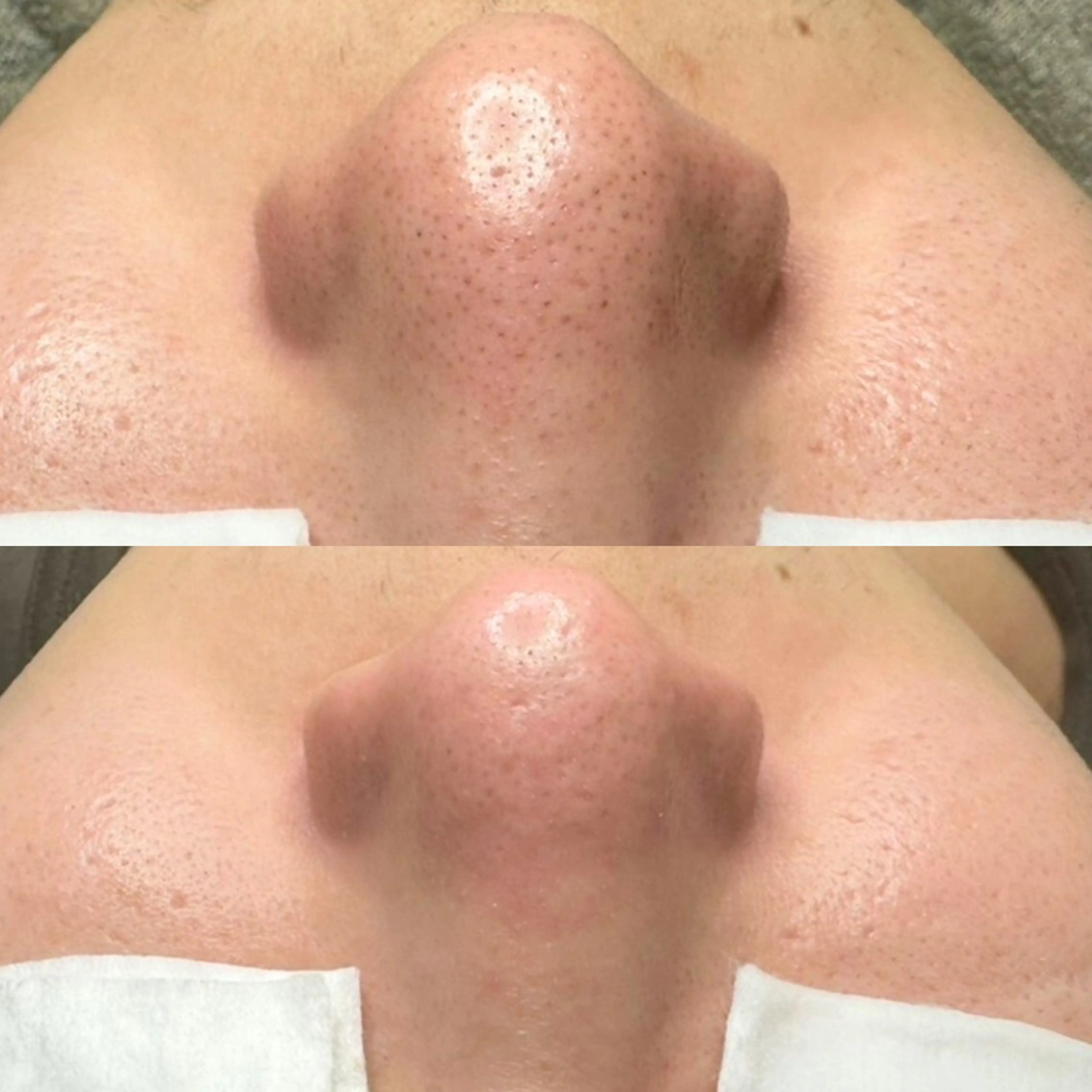 エステ 毛穴ケア特化専門店 トネア自由が丘店のエステ・リラクイメージ