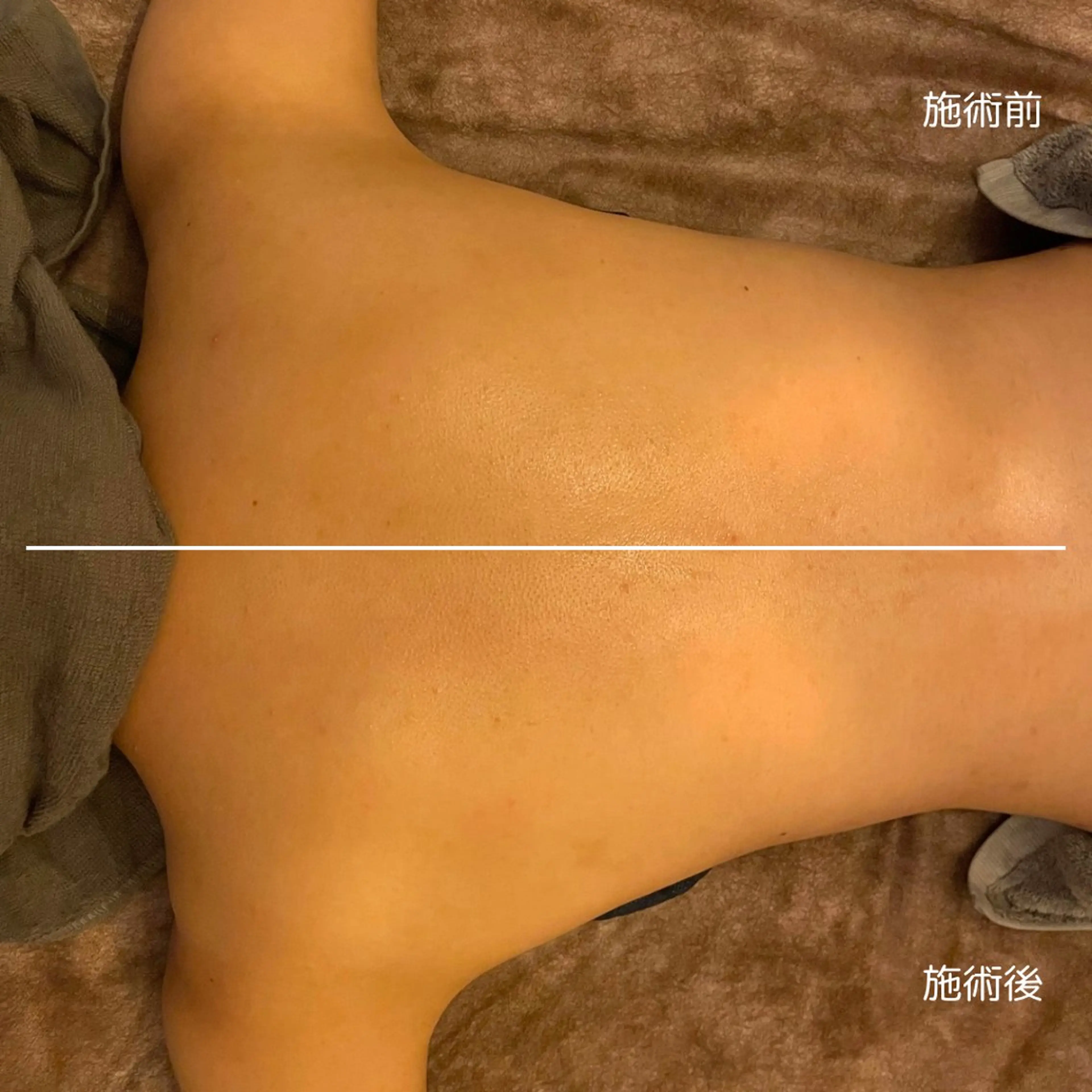 オフ:オン 全身筋膜マッサージのエステ・リラクイメージ