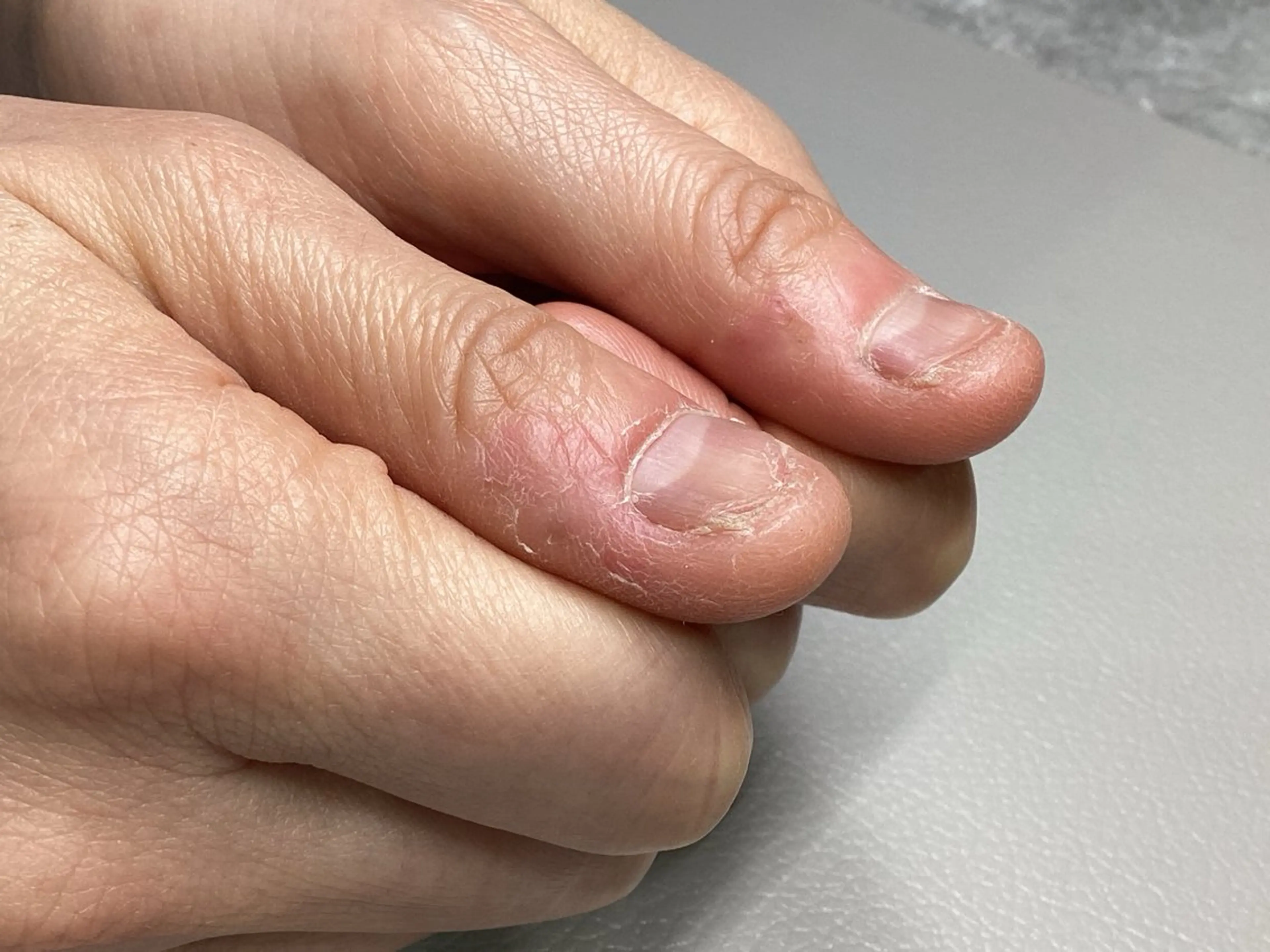 【カウンセリング】まずは爪悩み相談したいの写真