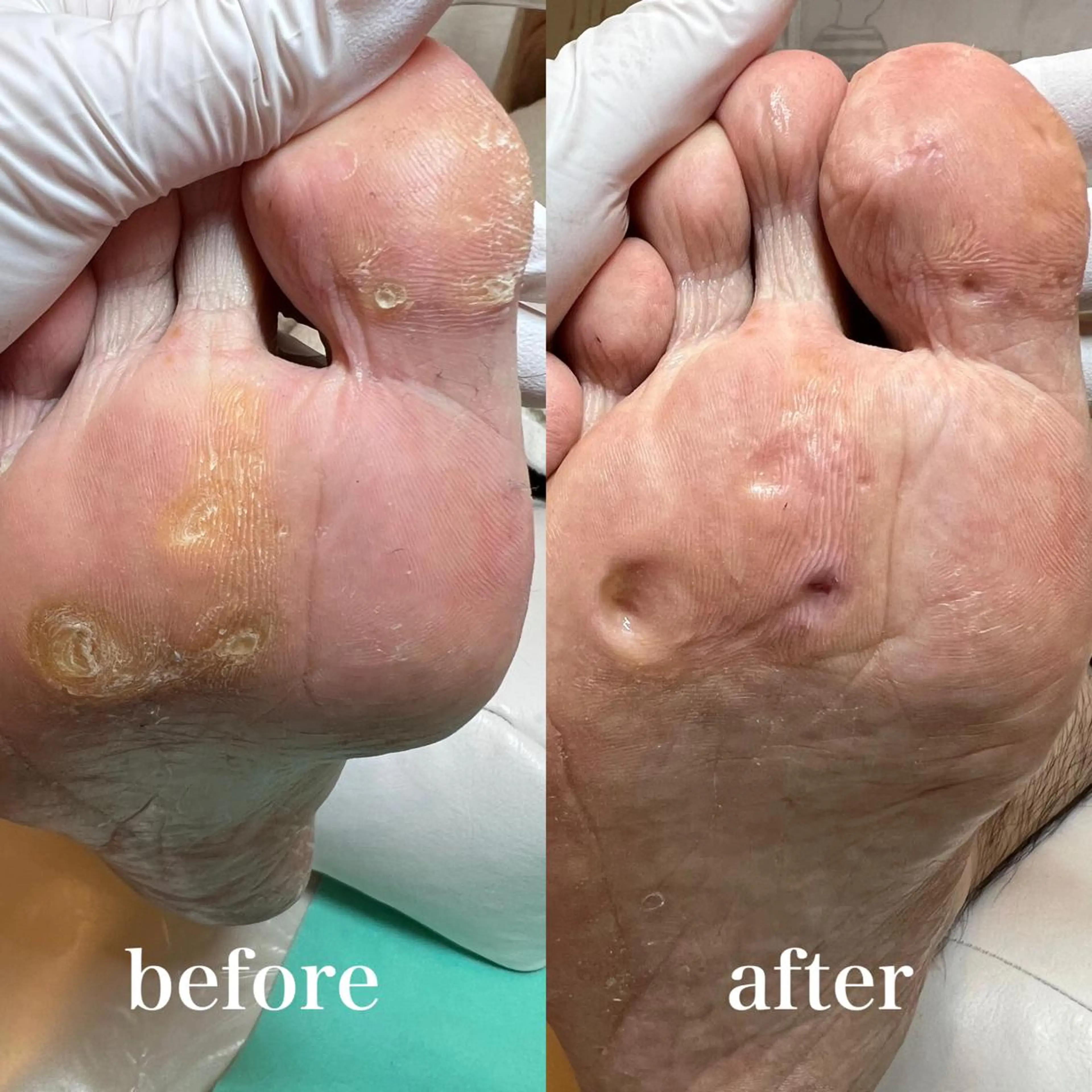 ネイル フットネイル 東京巻き爪アカデミー所属・東京巻き爪 アカデミーのエステ・リラクイメージ