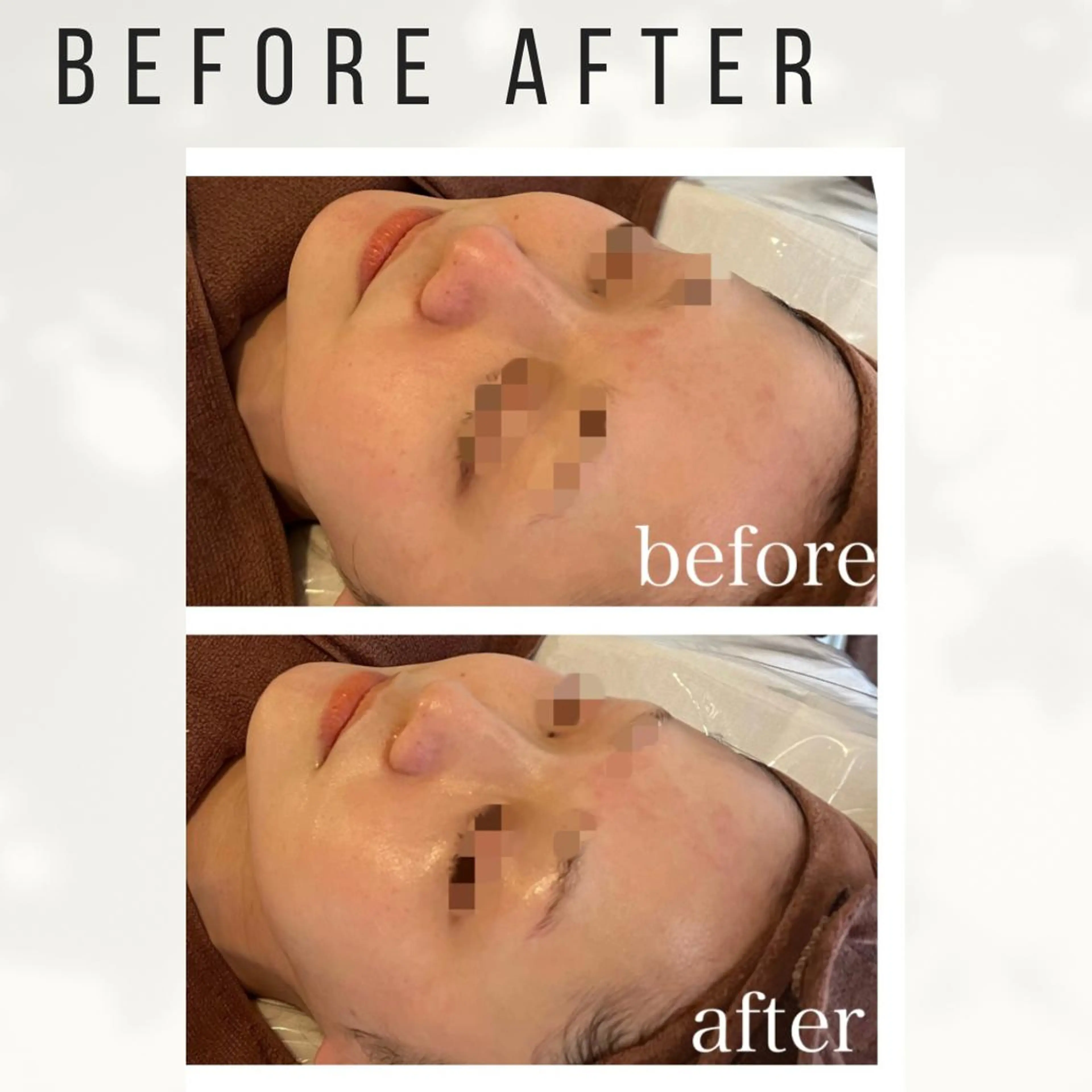 大人女性のための 肌管理サロン　ハピーのエステ・リラクイメージ