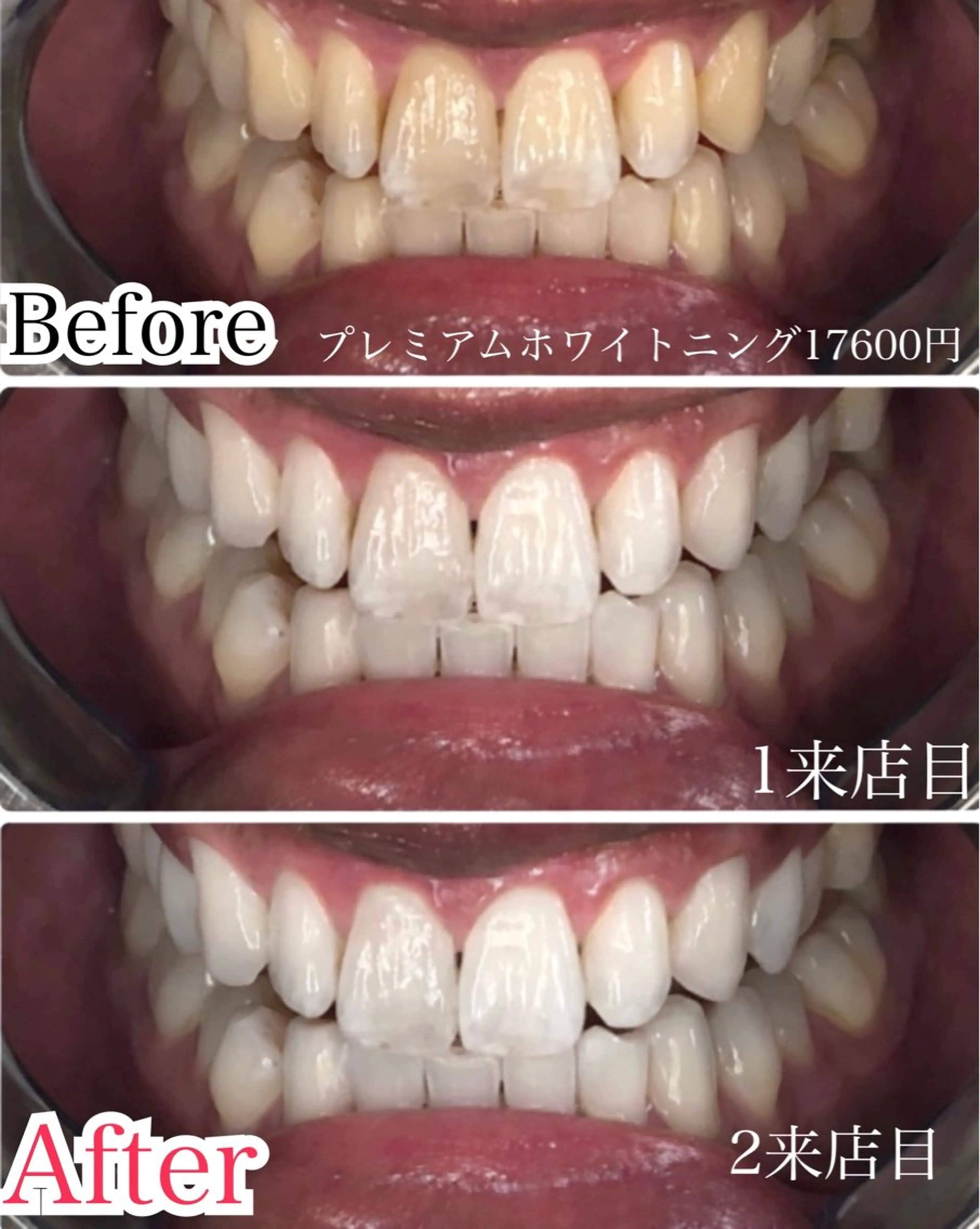 マツエク・マツパ 結婚式・ブライダル 【歯科提携】柏ホワイ トニングスタイルのその他イメージ