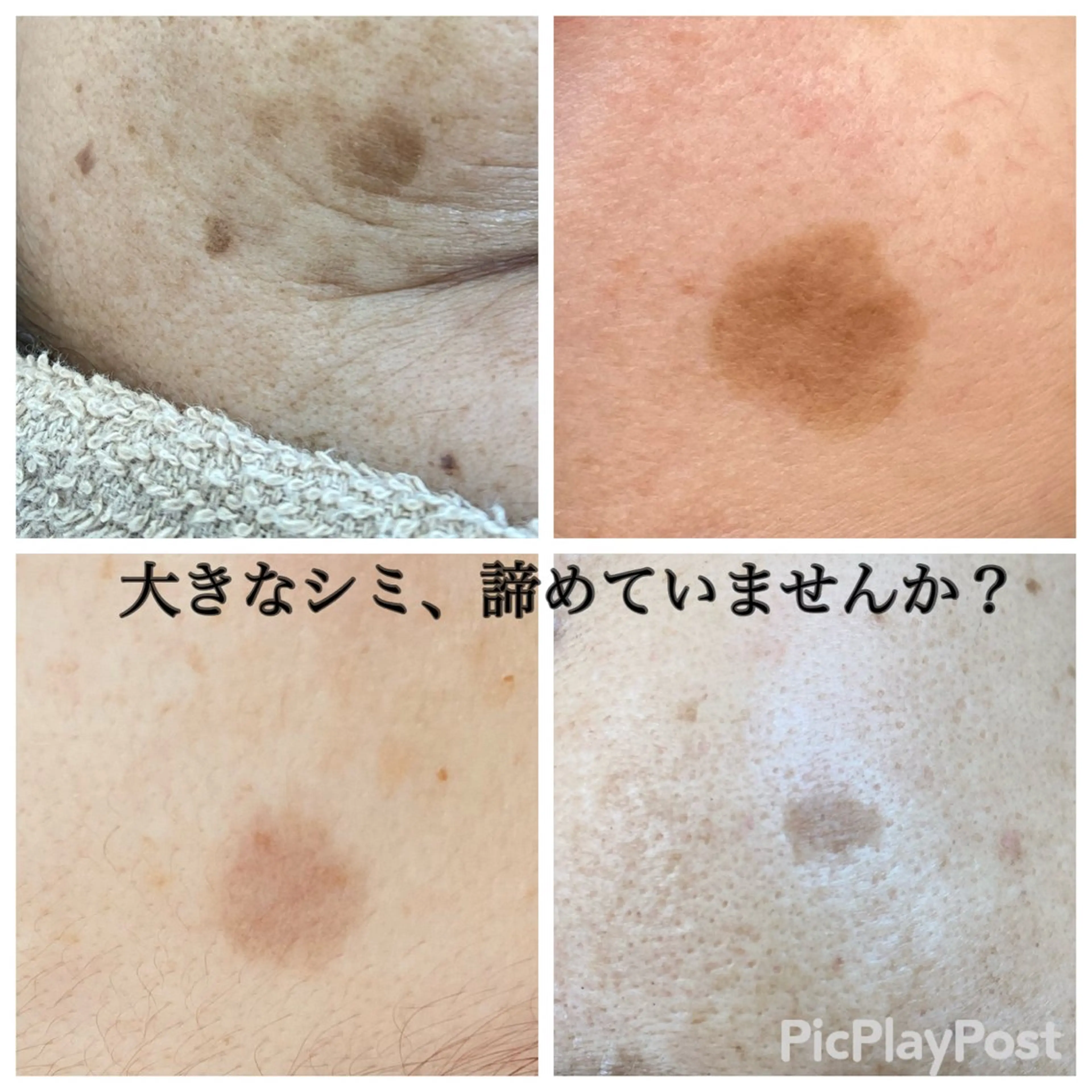 Ailes トータルビューティーのエステ・リラクイメージ