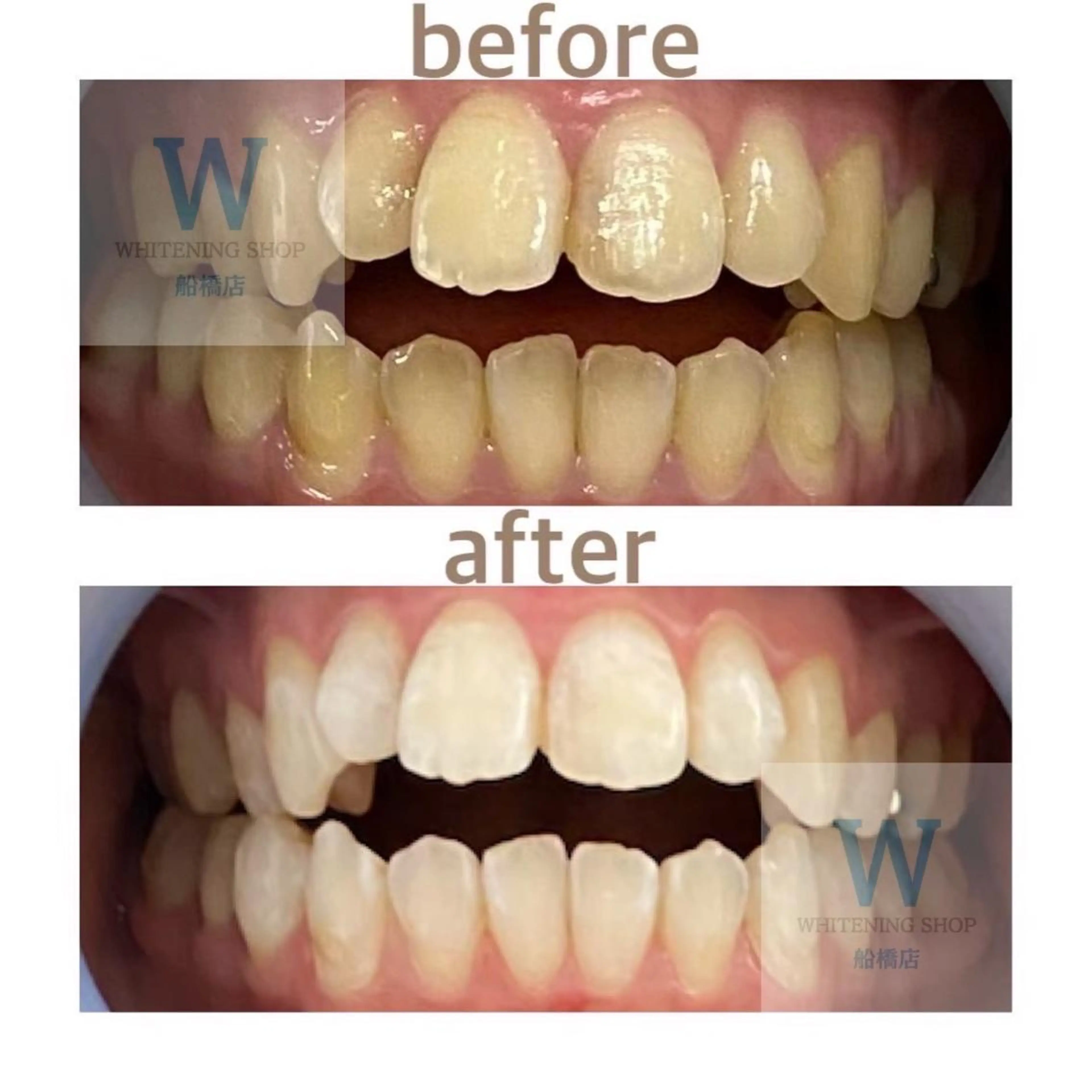 ホワイトニング ショップ船橋店🦷のエステ・リラクイメージ