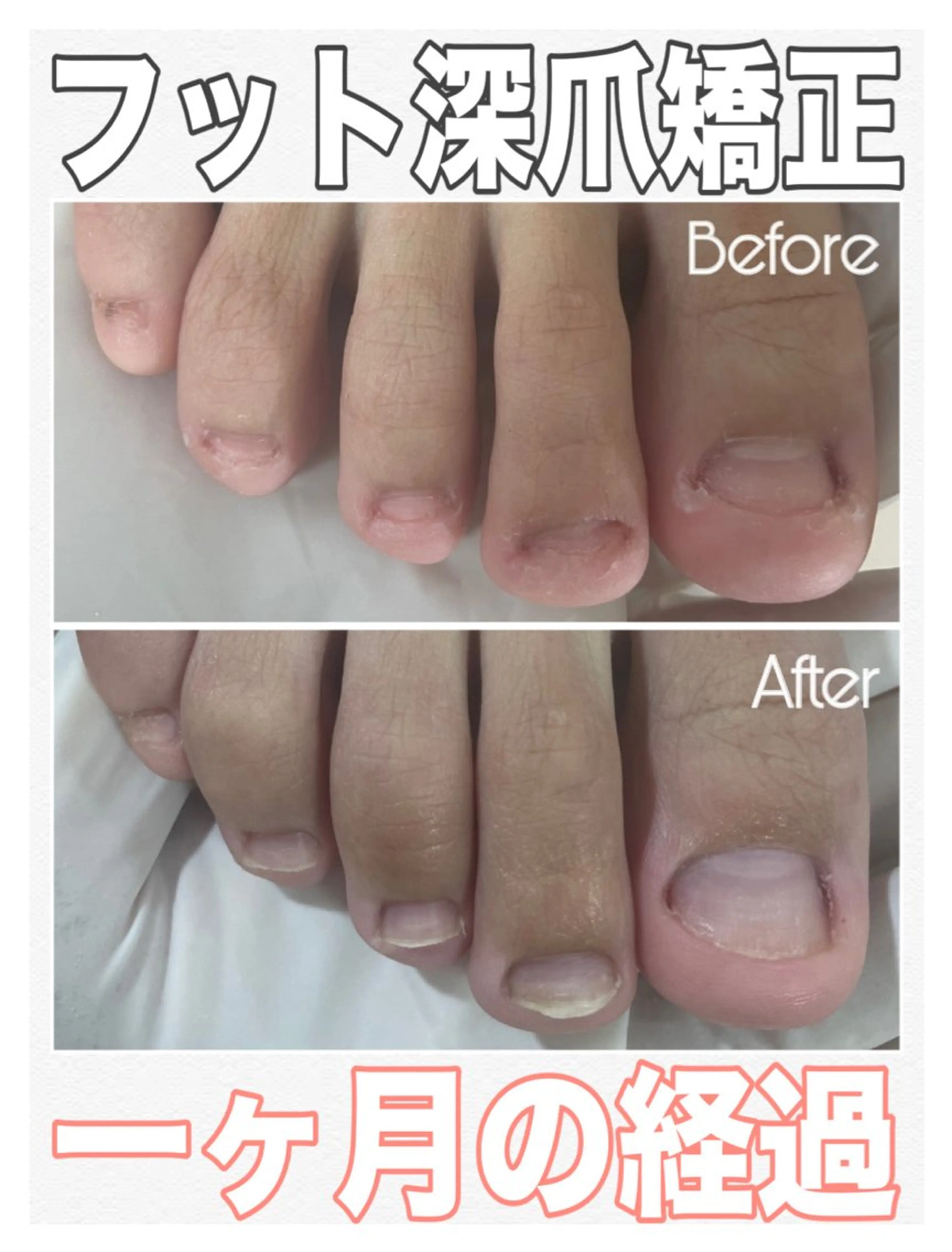 ネイル フットネイル フットネイル nail salon petillantのネイルデザイン
