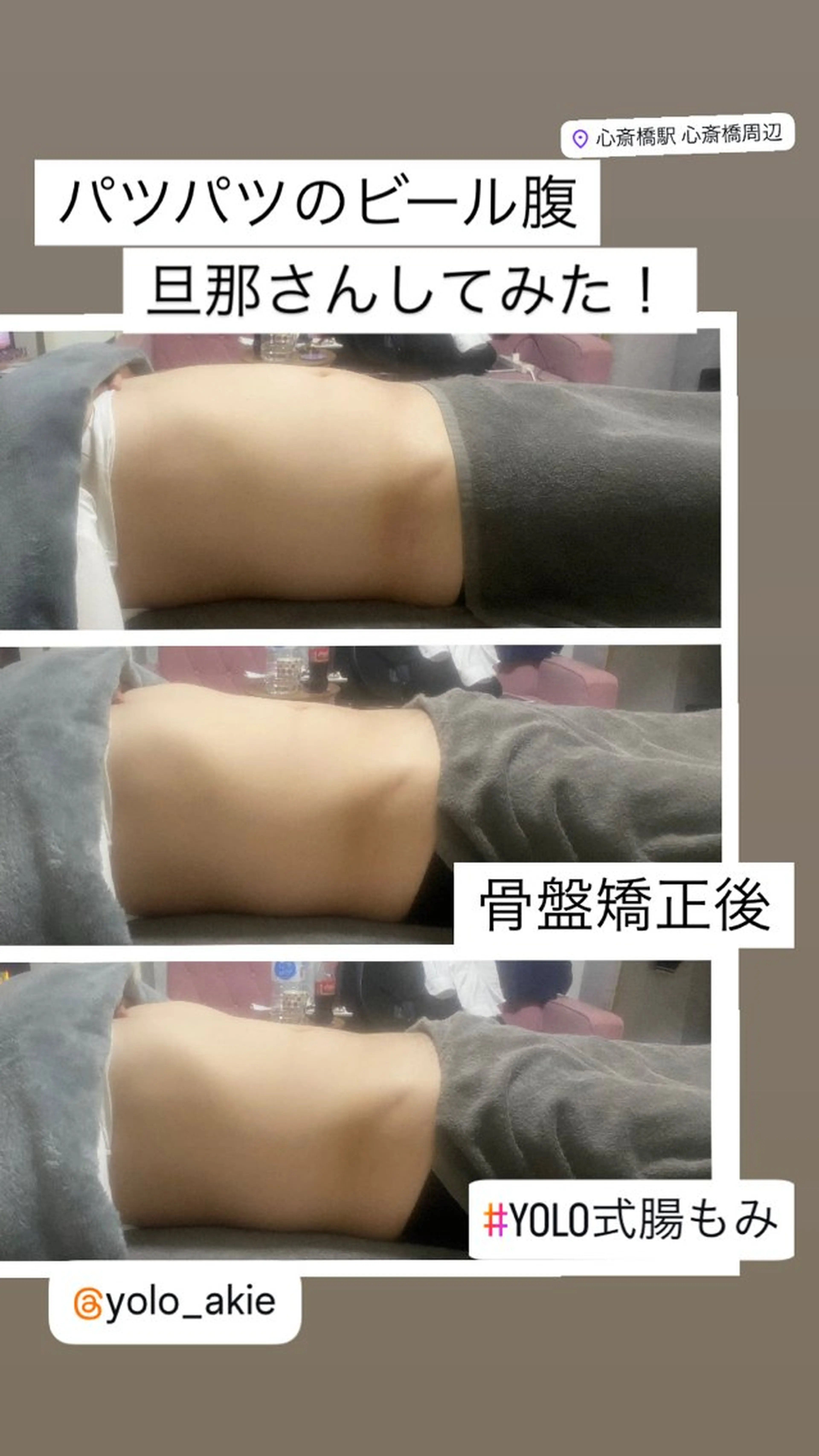 腸もみ➕骨盤矯正 施術時間60分の写真