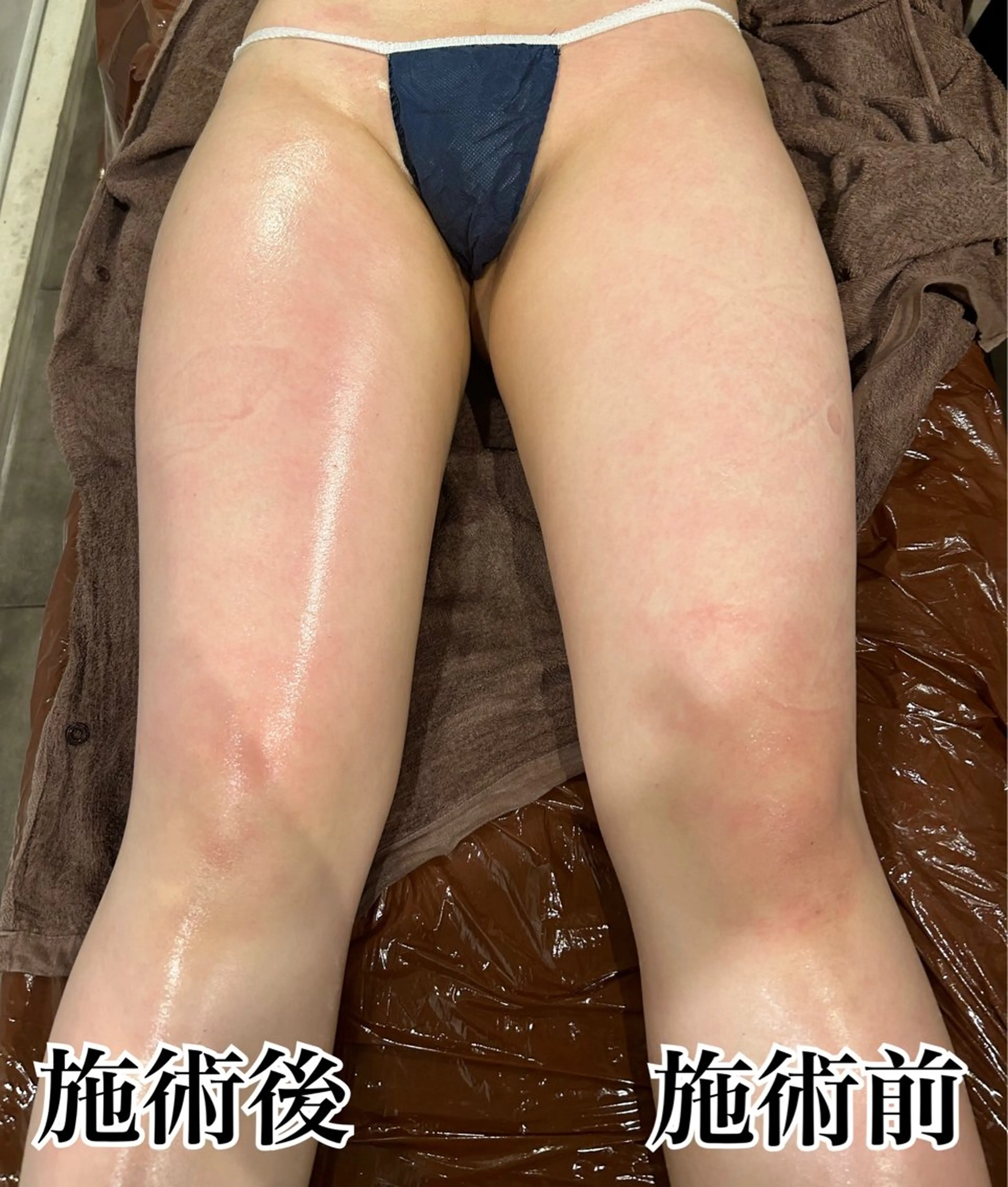 エステ Gemini 　MIKIのエステ・リラクイメージ