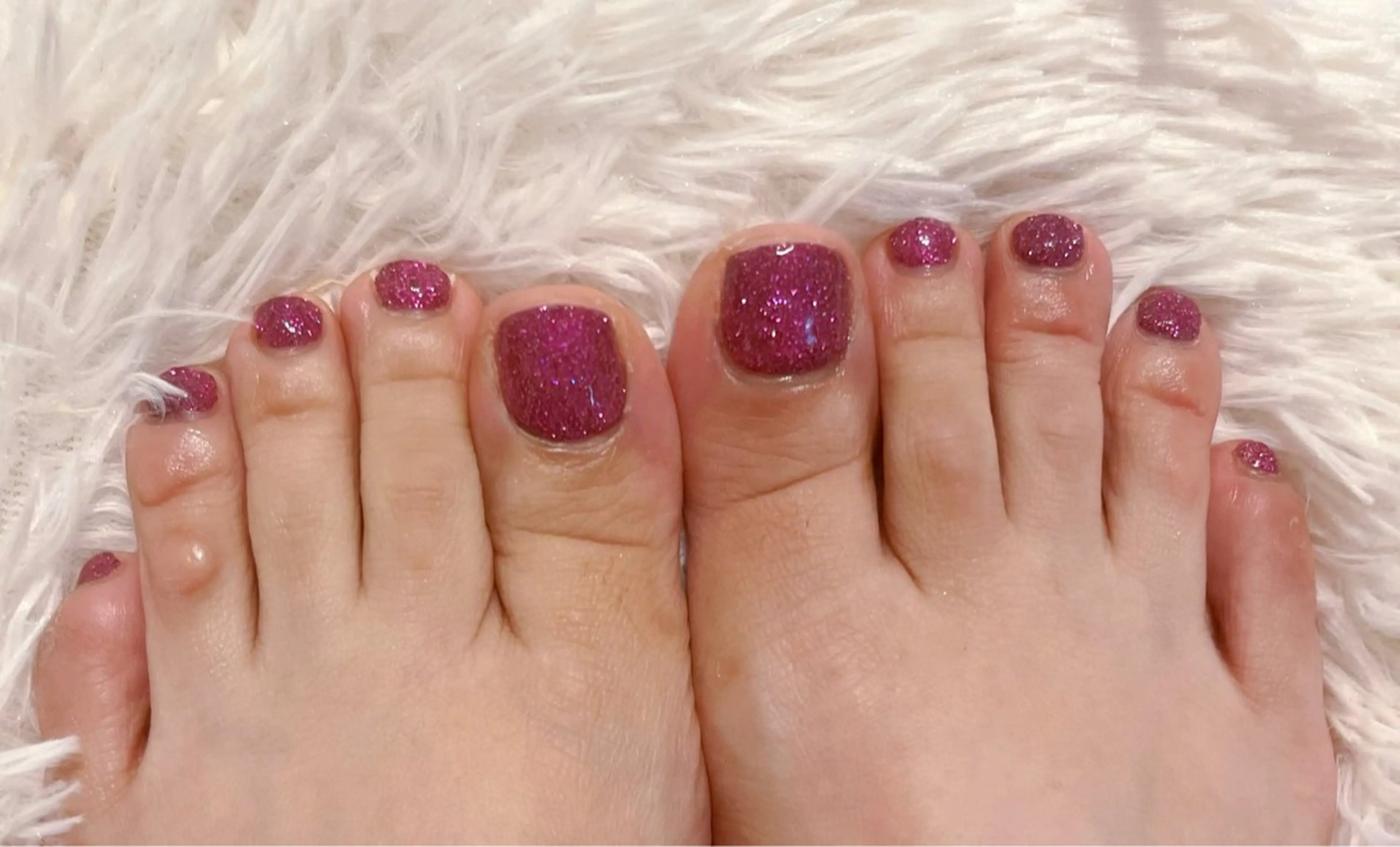 100類色から選びとピーリング除去組み合わせの写真