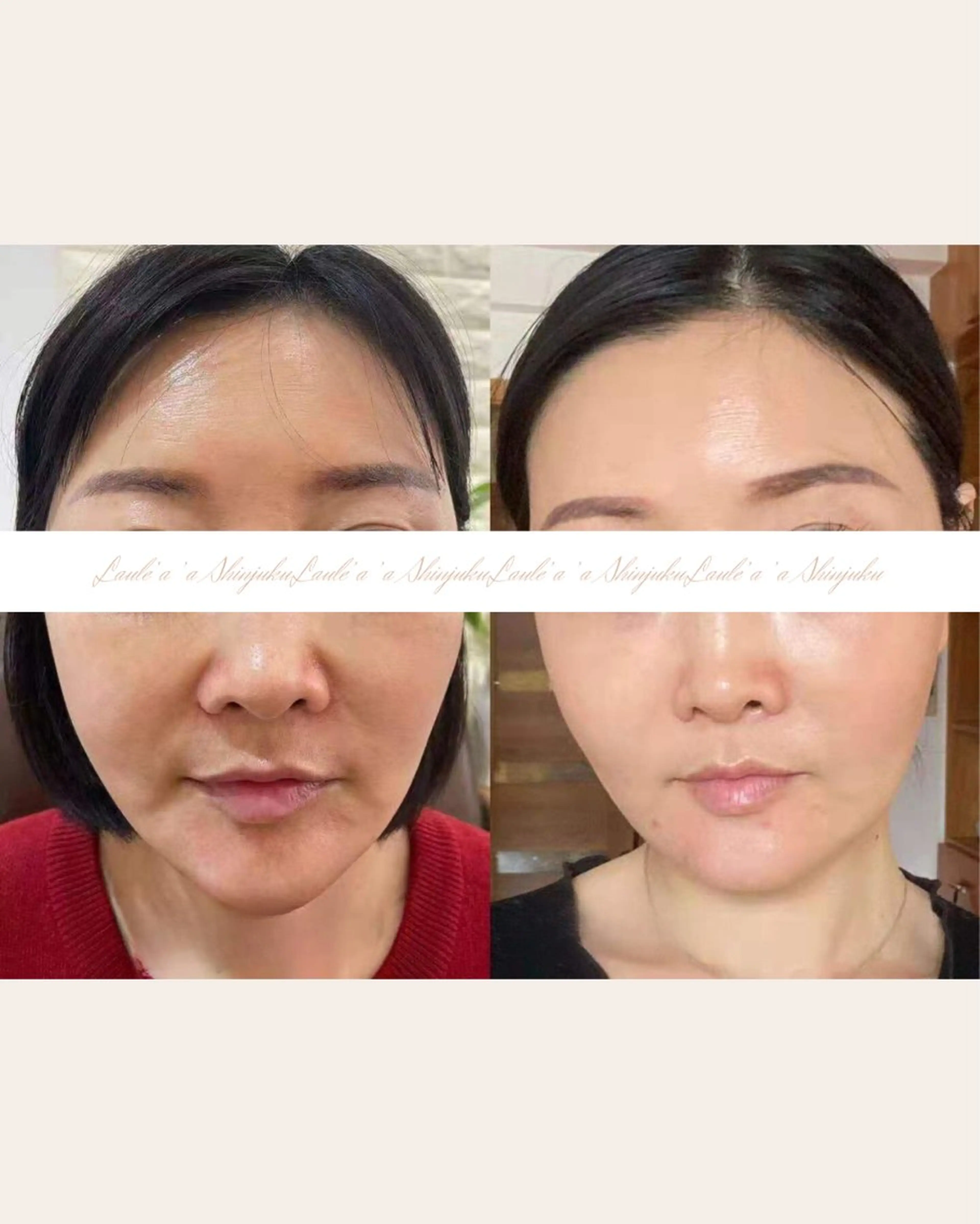 美腸サロン🌺 腸もみ/小顔/リンパのエステ・リラクイメージ