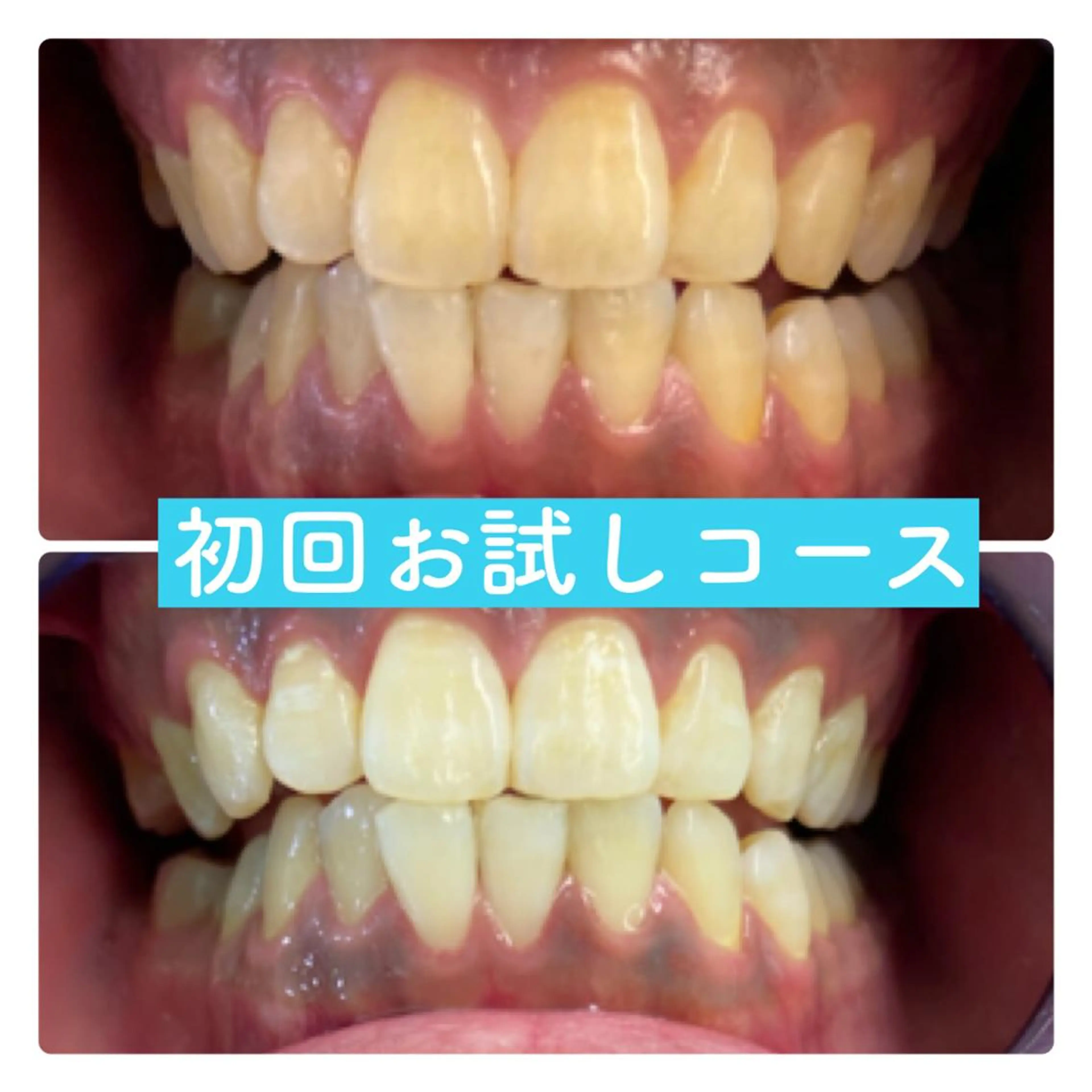 PLATINUM Beauty 横浜店所属・ホワイトニングルーム 横浜店のその他イメージ