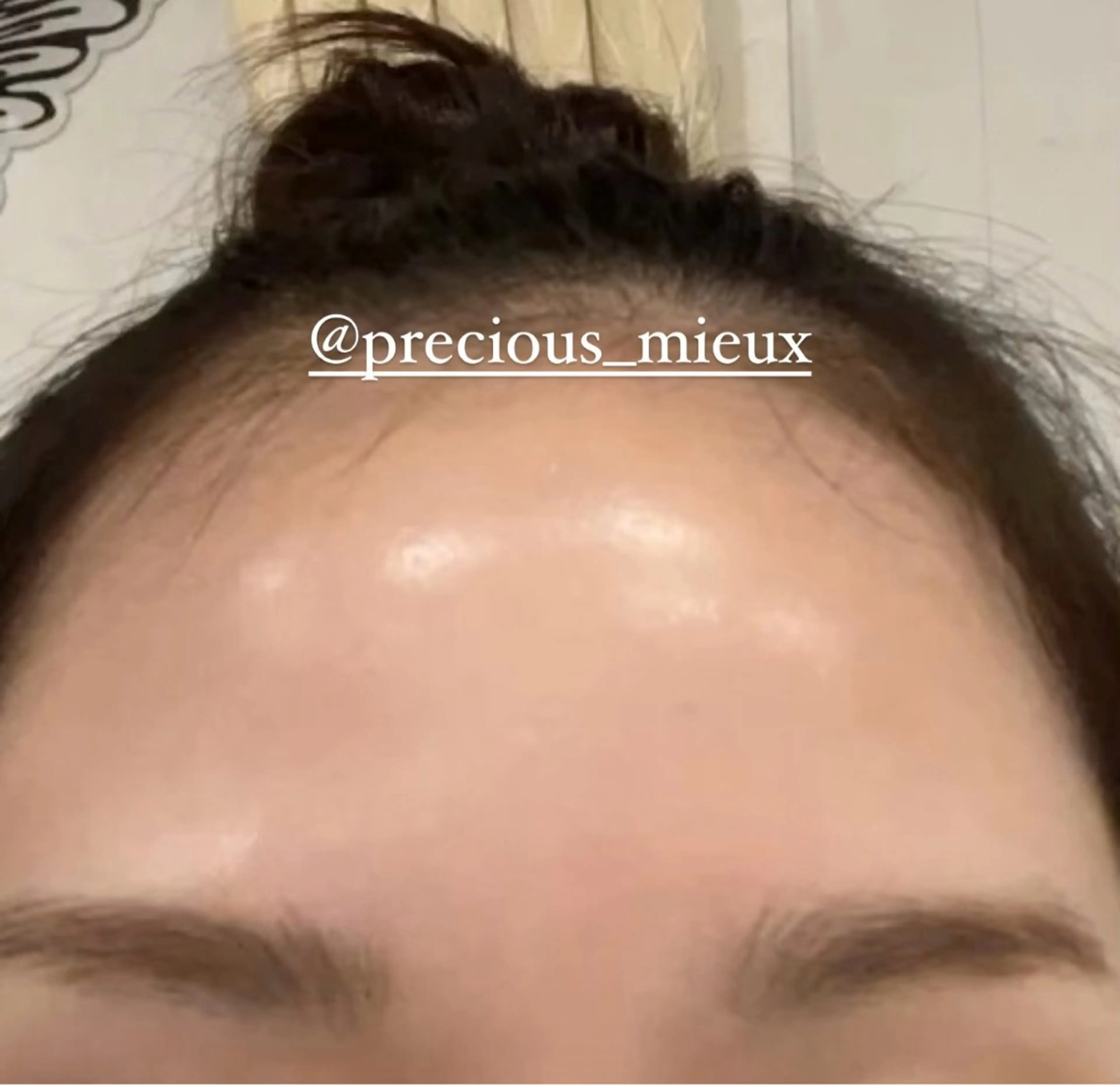 【ツルピカお肌の大掃除🫧カスタム】🉐毛穴ケアとピーリングのセット🌟 ※皮剥けするメニューです！アフターキット付🧡の写真