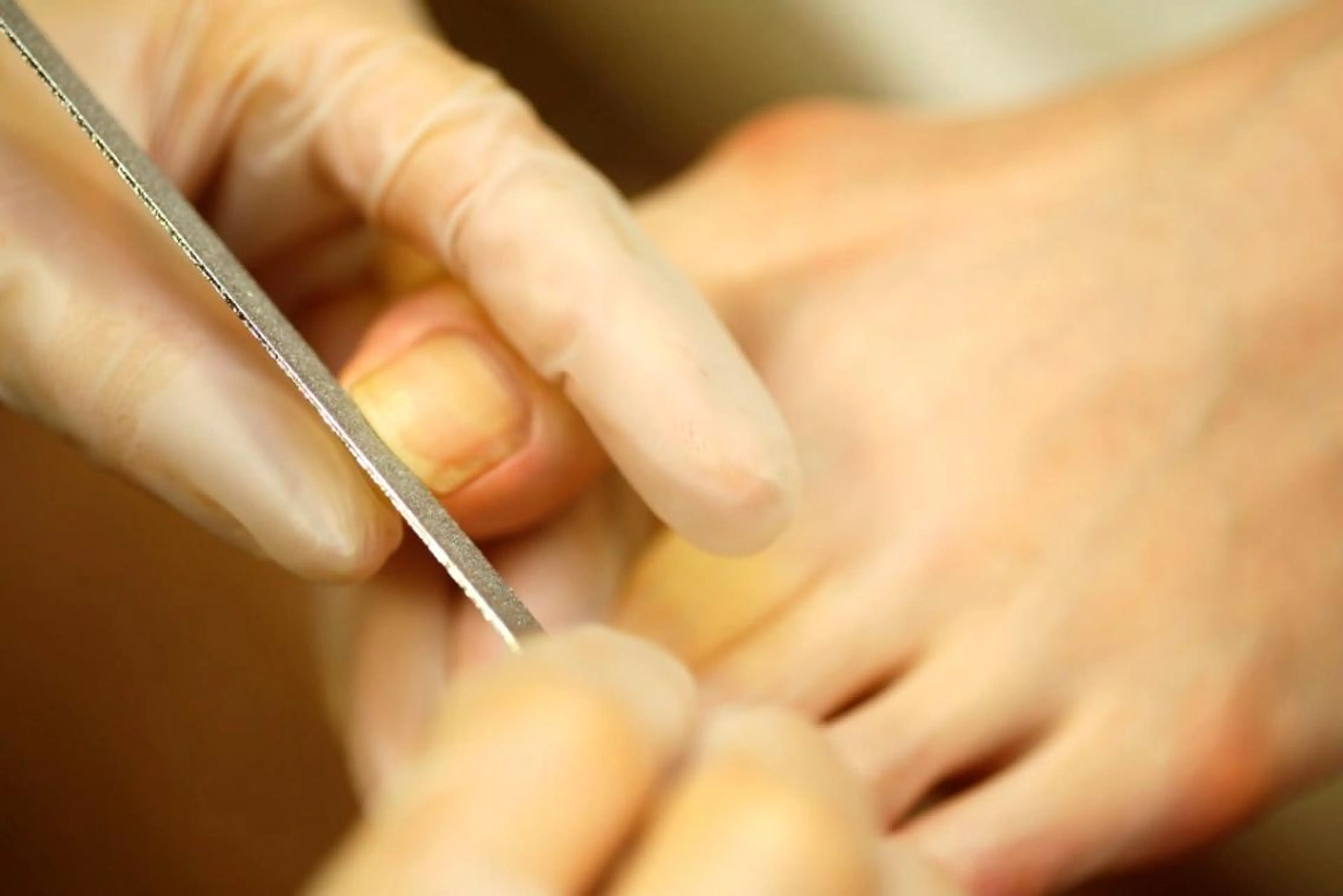 ◆足の爪トラブルケア◆ 【分厚い、でこぼこ、食い込み、変形など】　トラブル低​〜​中程度の写真