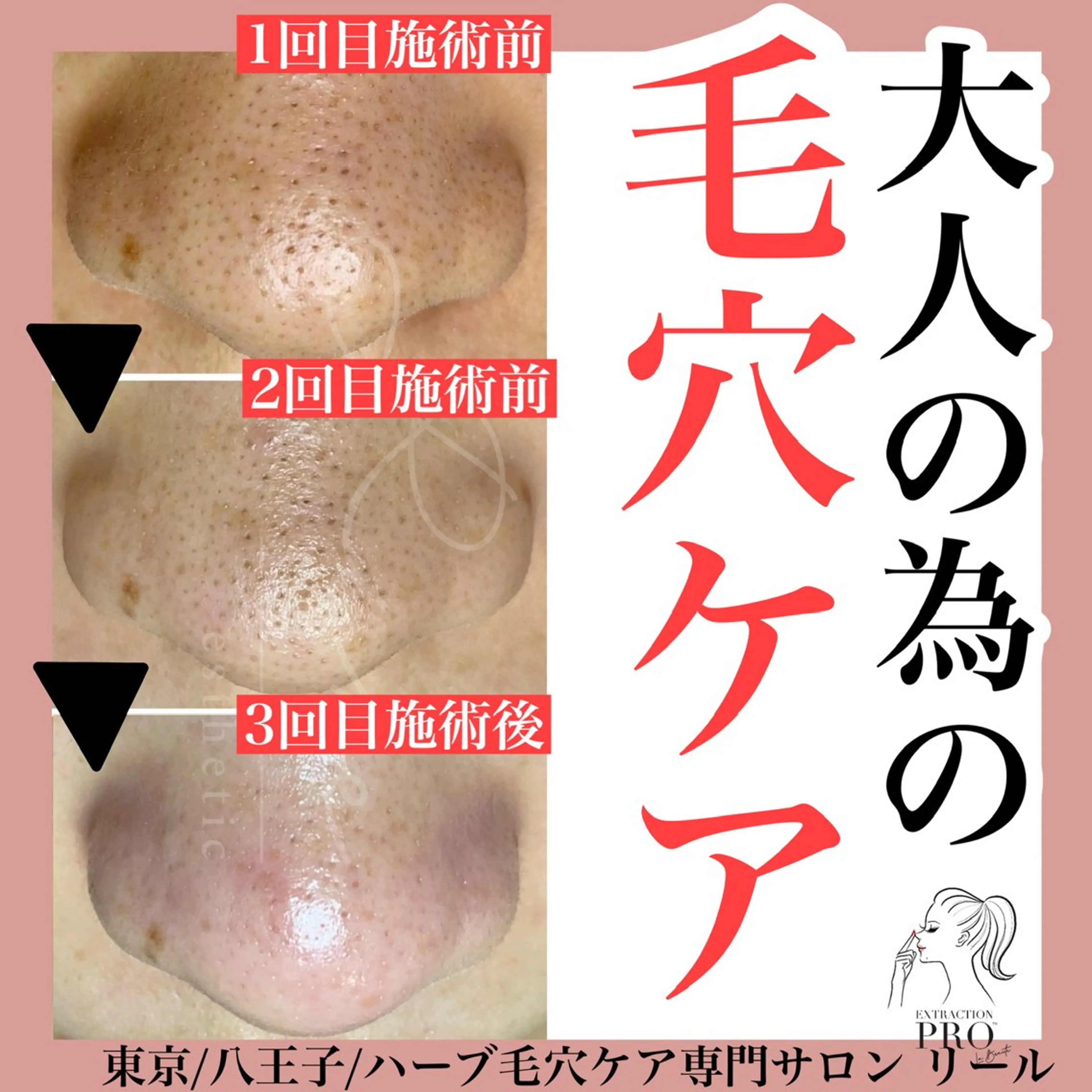 毛穴特化エステ -リールのエステ・リラクイメージ