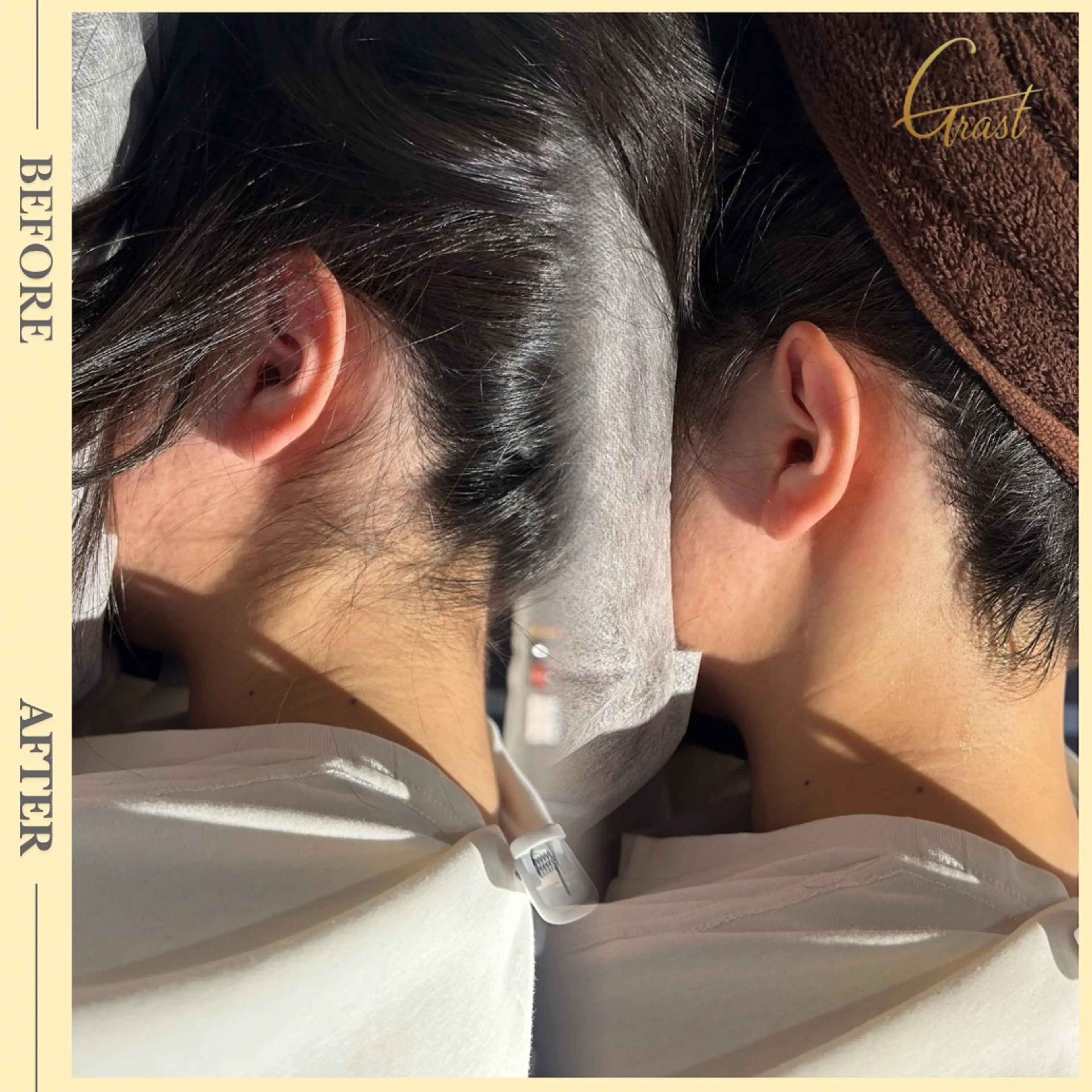 脱毛 ツヤ肌脱毛サロン Grast🌿アイカのエステ・リラクイメージ