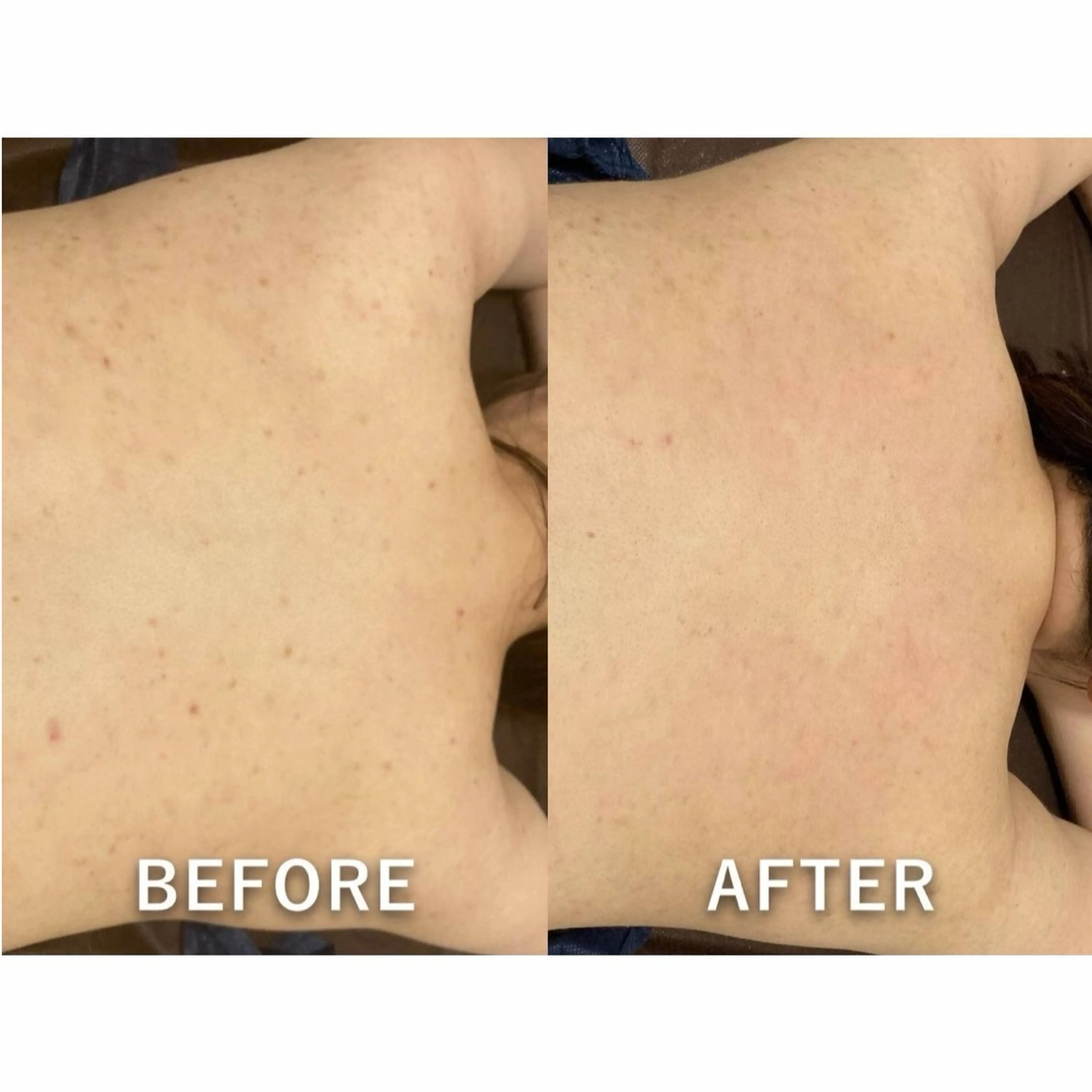 エステ 30minutes Rebeautyのエステ・リラクイメージ