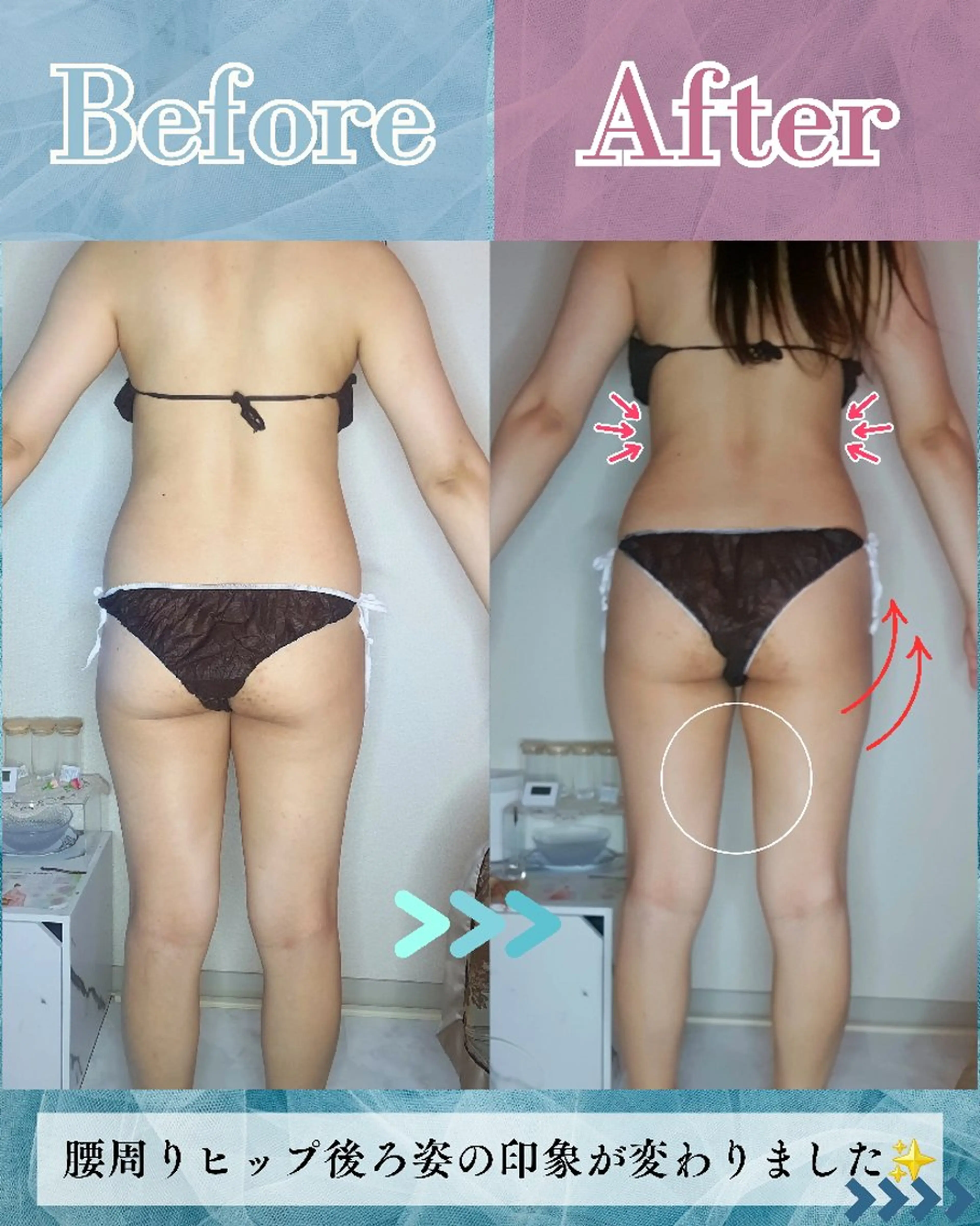 エステ リラク 痩身ハーブピーリング 筋膜リリース☆B&Hのエステ・リラクイメージ